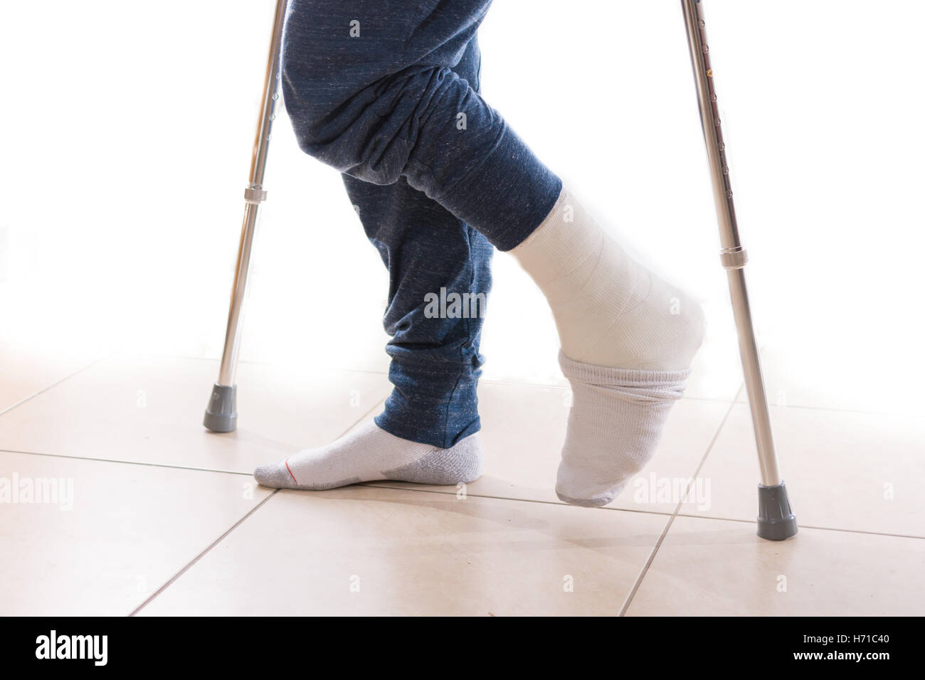 Junger Mann mit einem gebrochenen Knöchel und weißen Gipsbein mit einer Socke zu helfen, halten seine Zehen warm, zu Fuß auf Krücken (isoliert auf w Stockfoto