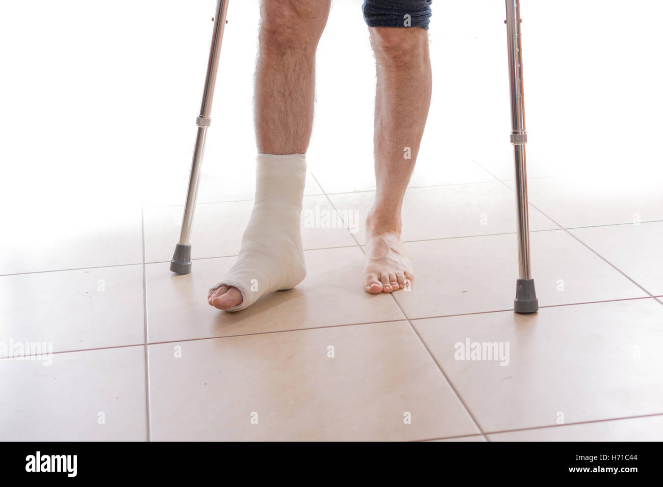 Junger Mann mit einem gebrochenen Knöchel und eine weiße werfen am Bein, zu Fuß auf Krücken (isoliert auf weiss) Stockfoto