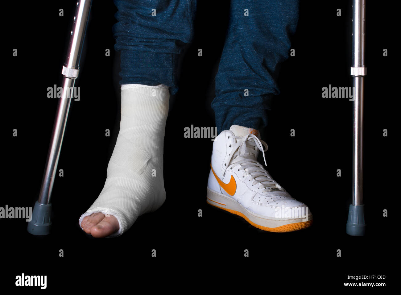 NEW YORK - 18. Mai 2016: Junger Mann mit einem gebrochenen Knöchel und ein weißes Bein infolge eines Unfalls Basketball anschlagen zu Fuß auf c Stockfoto
