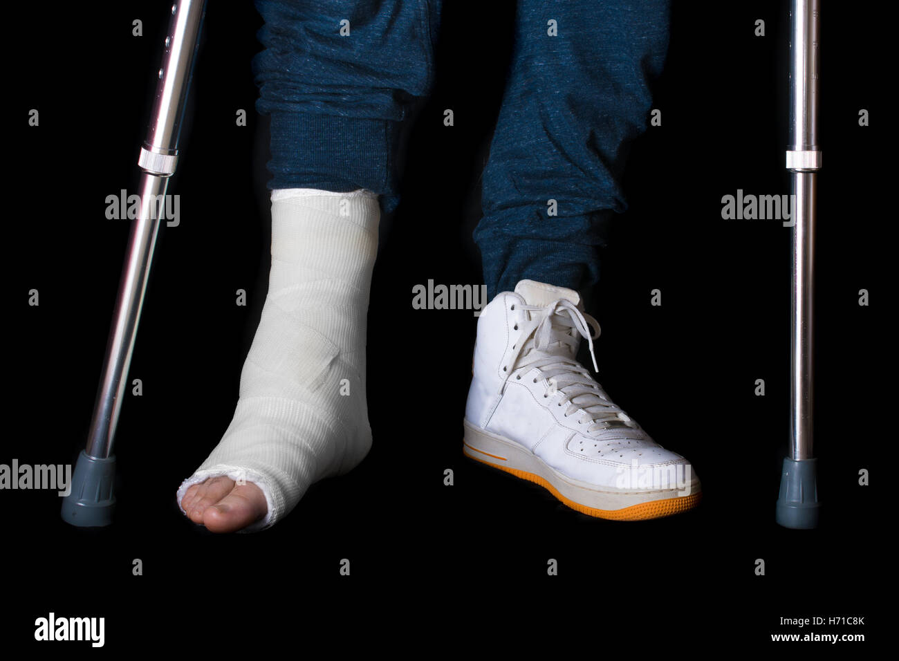 Junger Mann mit einem gebrochenen Knöchel und ein weißes Bein infolge eines Unfalls Basketball anschlagen zu Fuß auf Krücken mit einem High-Top-b Stockfoto