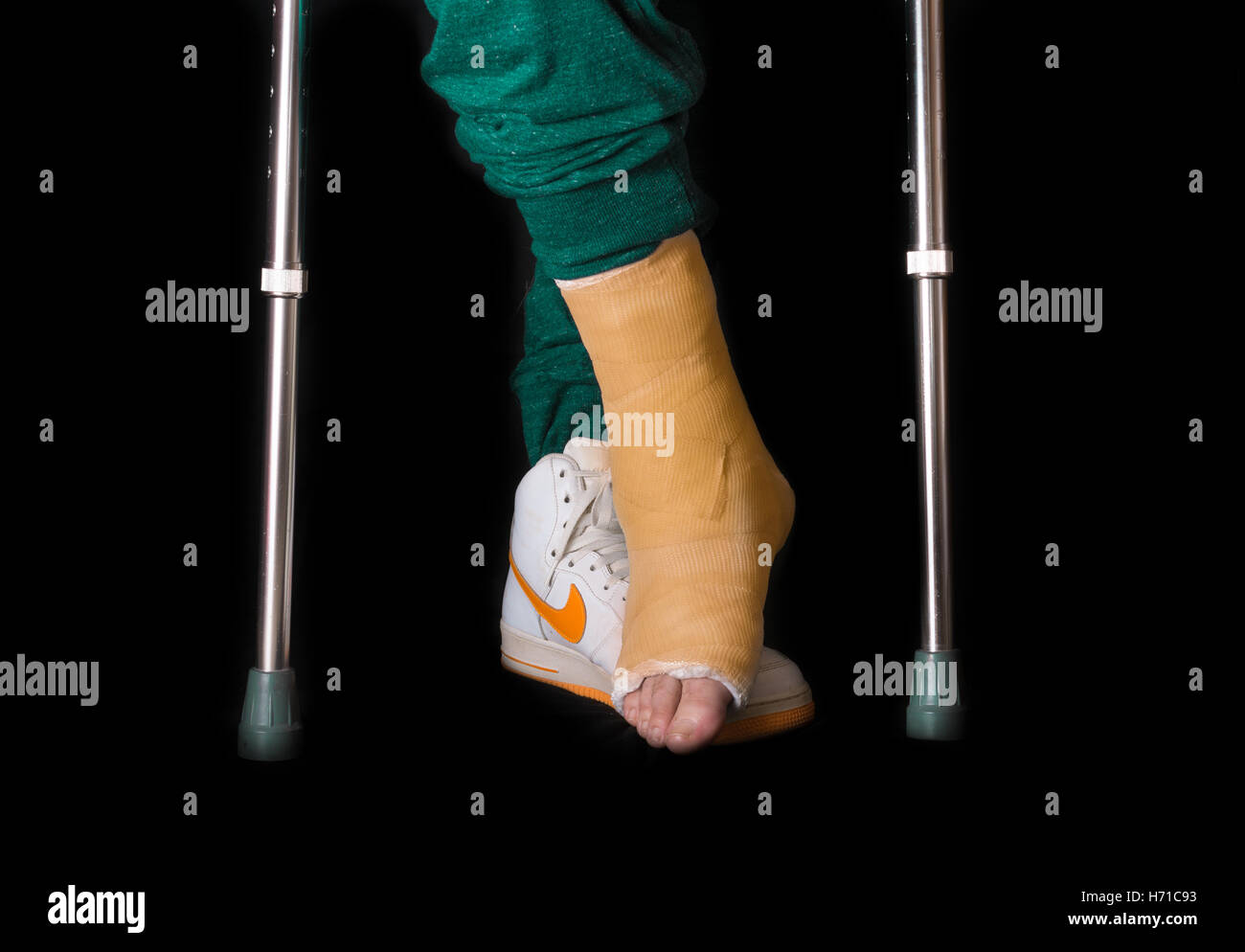 NEW YORK - 18. Mai 2016: Junger Mann mit einem gebrochenen Knöchel und eine Orange am Bein nach einem Unfall Basketball werfen zu Fuß auf Stockfoto
