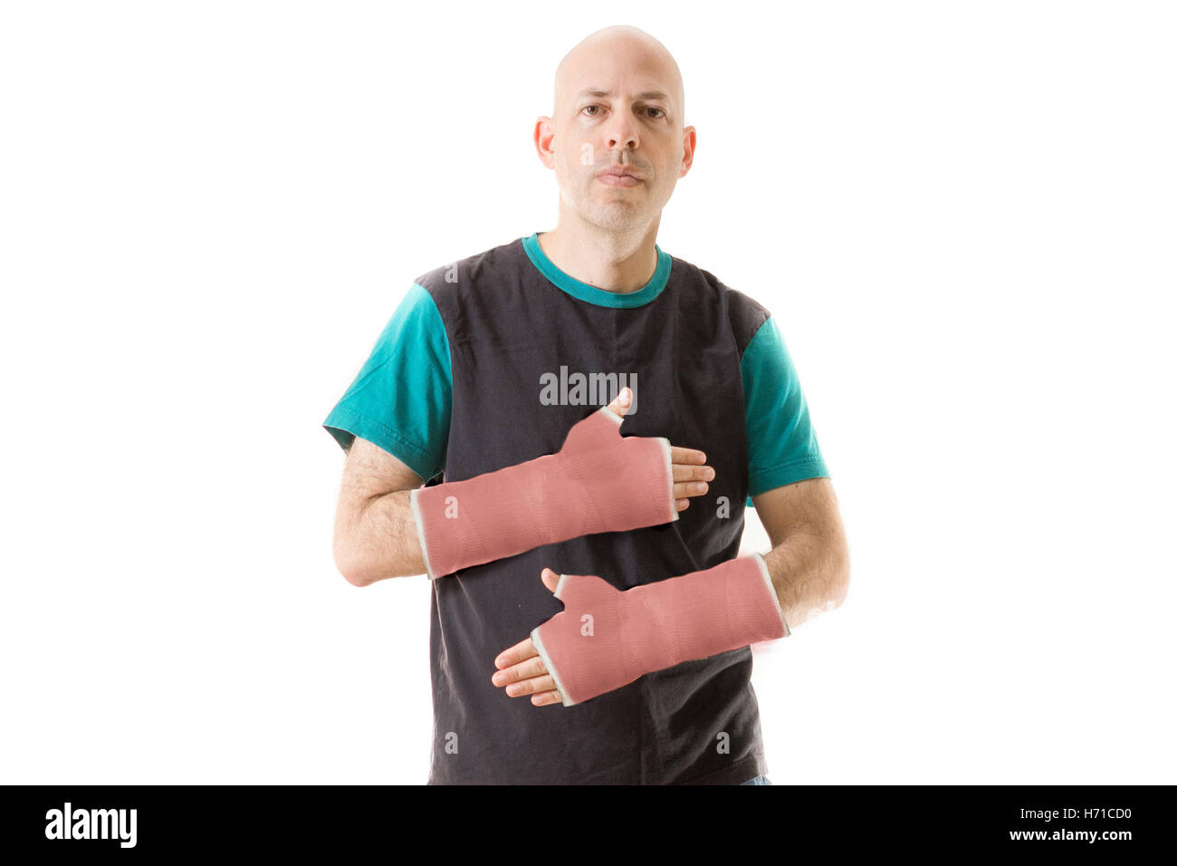 Junger Mann nach einem schweren Unfall mit zwei gebrochenen Handgelenken und zwei rote Fiberglas Arm Gipsverbände (isoliert auf weiss) Stockfoto