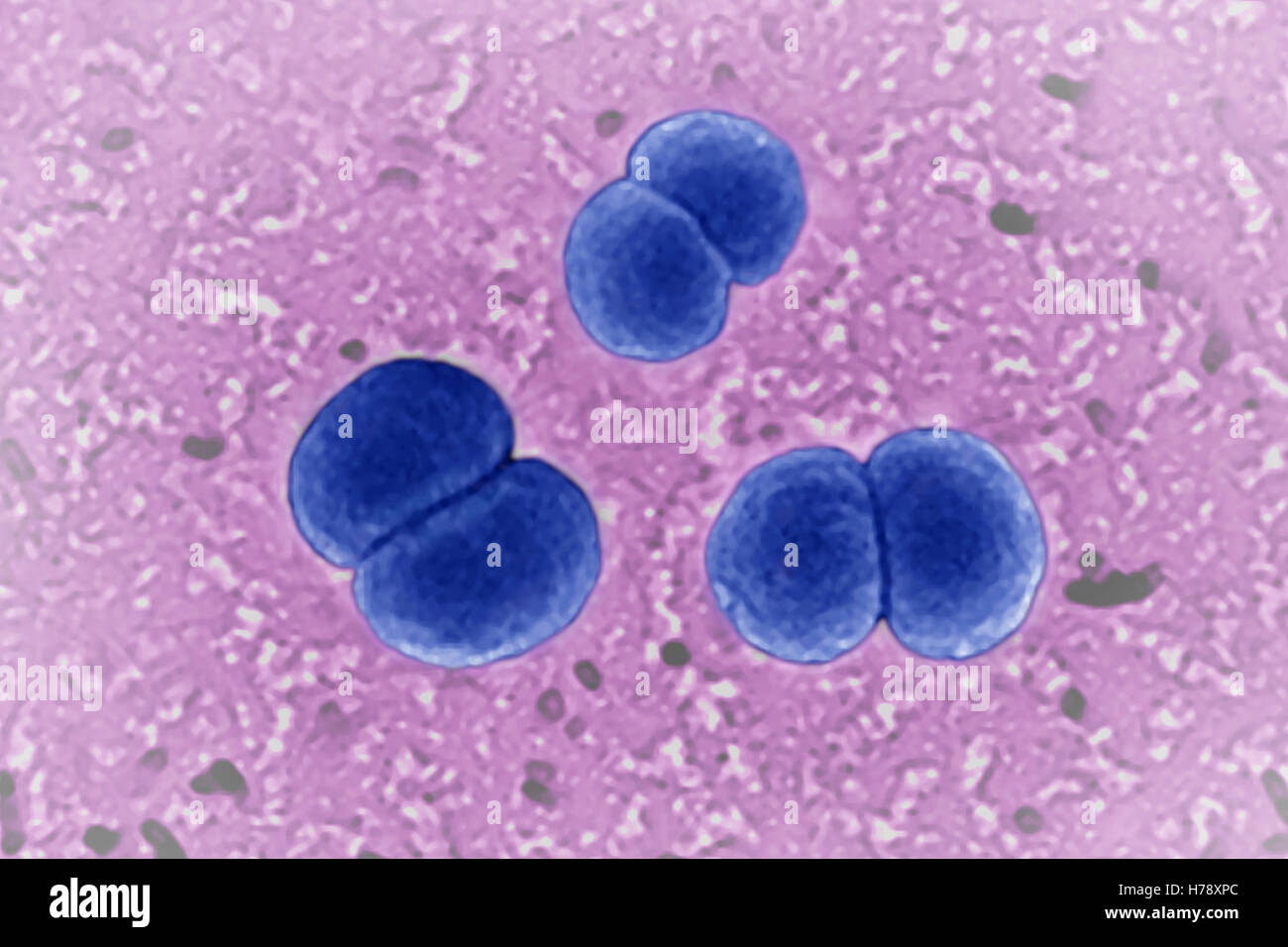 NEISSERIA MENINGITIDIS Stockfoto