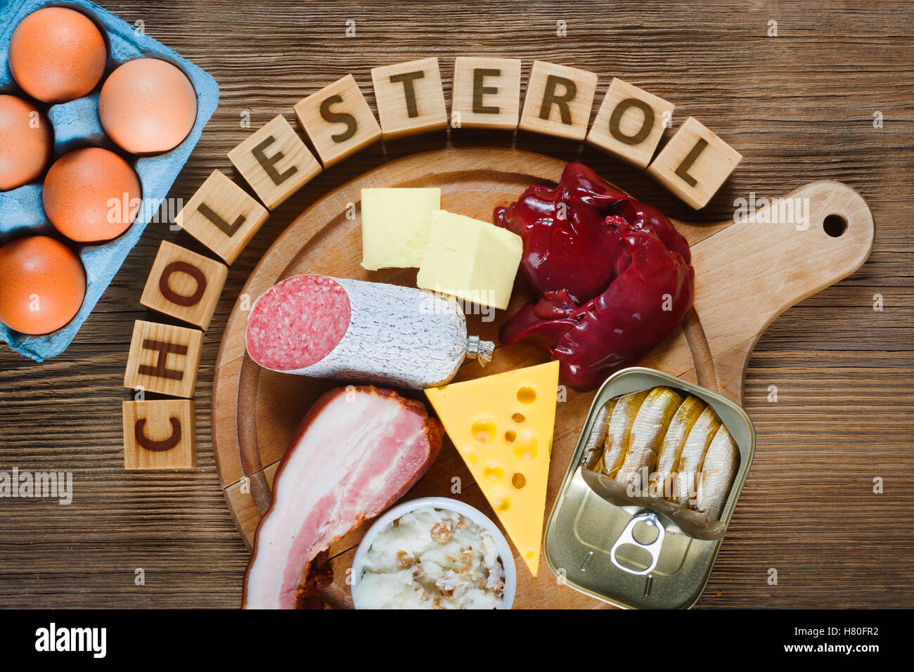 Cholesterinreiche Lebensmittel wie Leber, gelben Käse, Butter, Eiern, Speck, Schmalz mit Zwiebeln, Sardinen in Öl. Holztisch als Zeitmessung Stockfoto