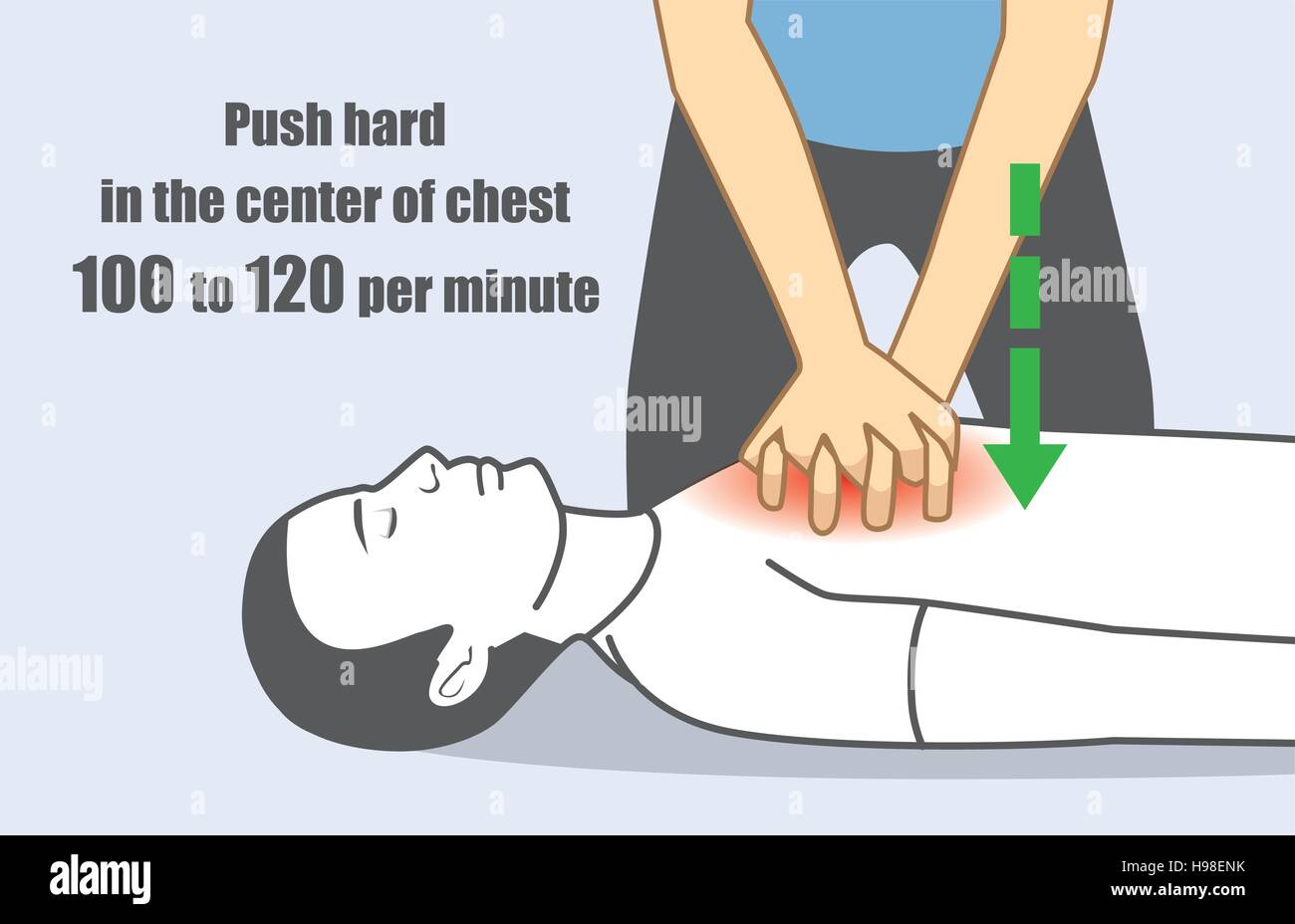 Hand drücken Sie hart und schnell in der Mitte der Brust 100 bis 120 pro Minute. Stock Vektor