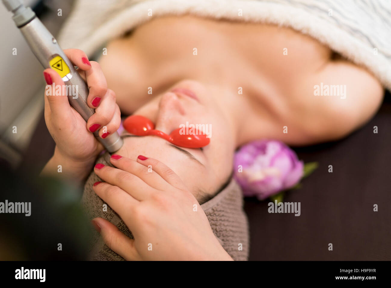 Laser-Behandlung um Gesichtshaut Unvollkommenheiten in einem Schönheitssalon zu entfernen. Stockfoto