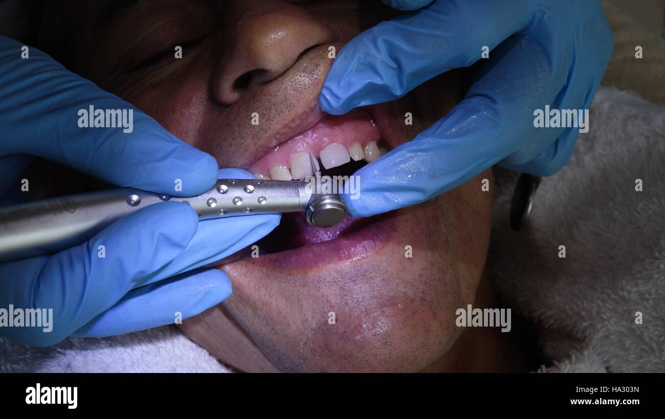 Oralchirurgie und Zahnmedizin Stockfoto