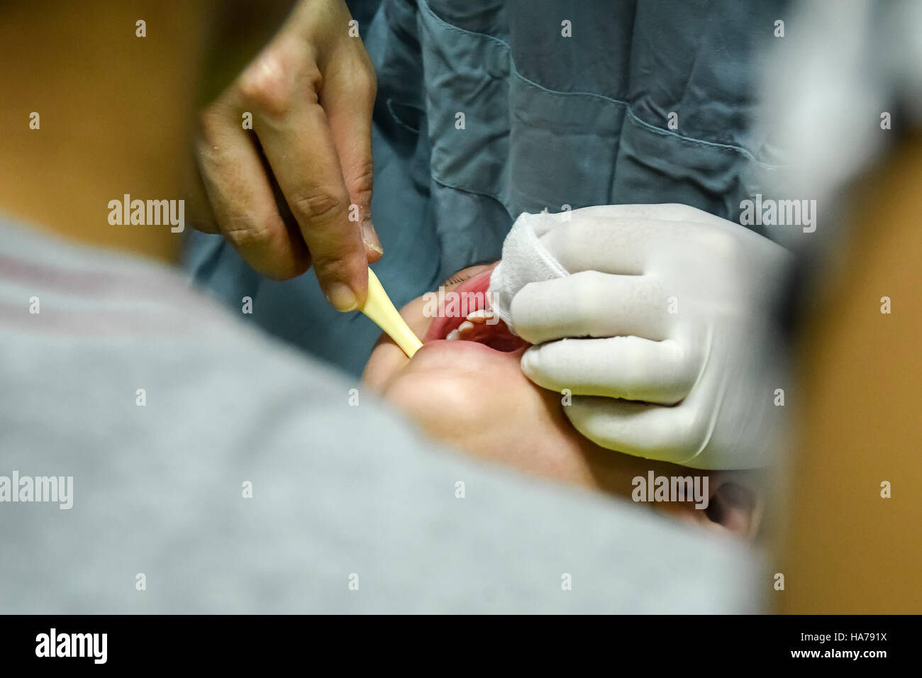 CHIANG MAI, Thailand - 18 April 2016:Doctor Zahnarzt ein Kind zum Zähneputzen zu unterrichten. Medizinisches Konzept. CHIANG MAI, Thailand. Stockfoto