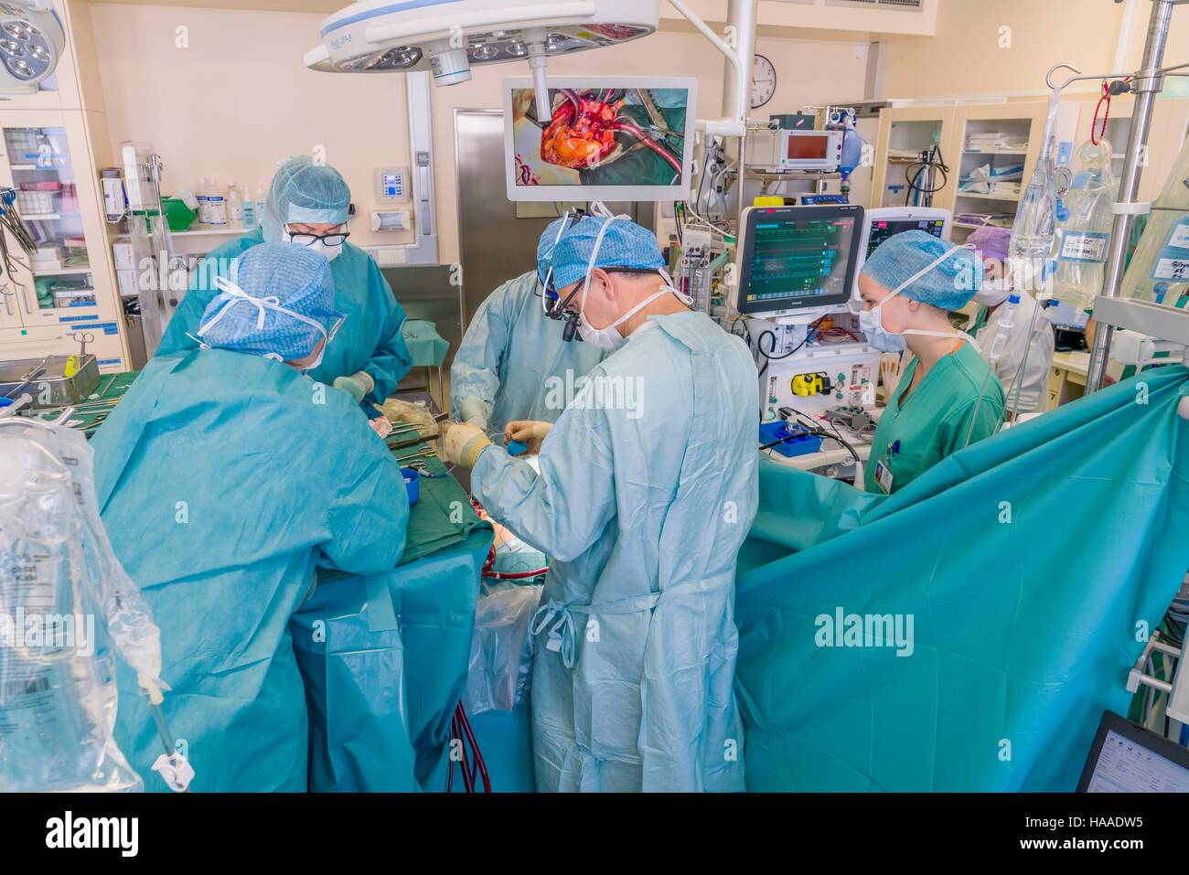 Chirurgen-Ersatz Herzklappenoperation, OP-Saal, Reykjavik, Island Stockfoto