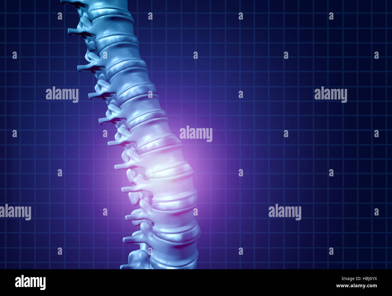 Rücken Rückenschmerzen und menschlichen Rückenschmerzen als Skelett zeigt die Wirbelsäule und die Wirbelsäule in leuchtenden Höhepunkt als ein medizinisches Gesundheits-Konzept für spin Stockfoto