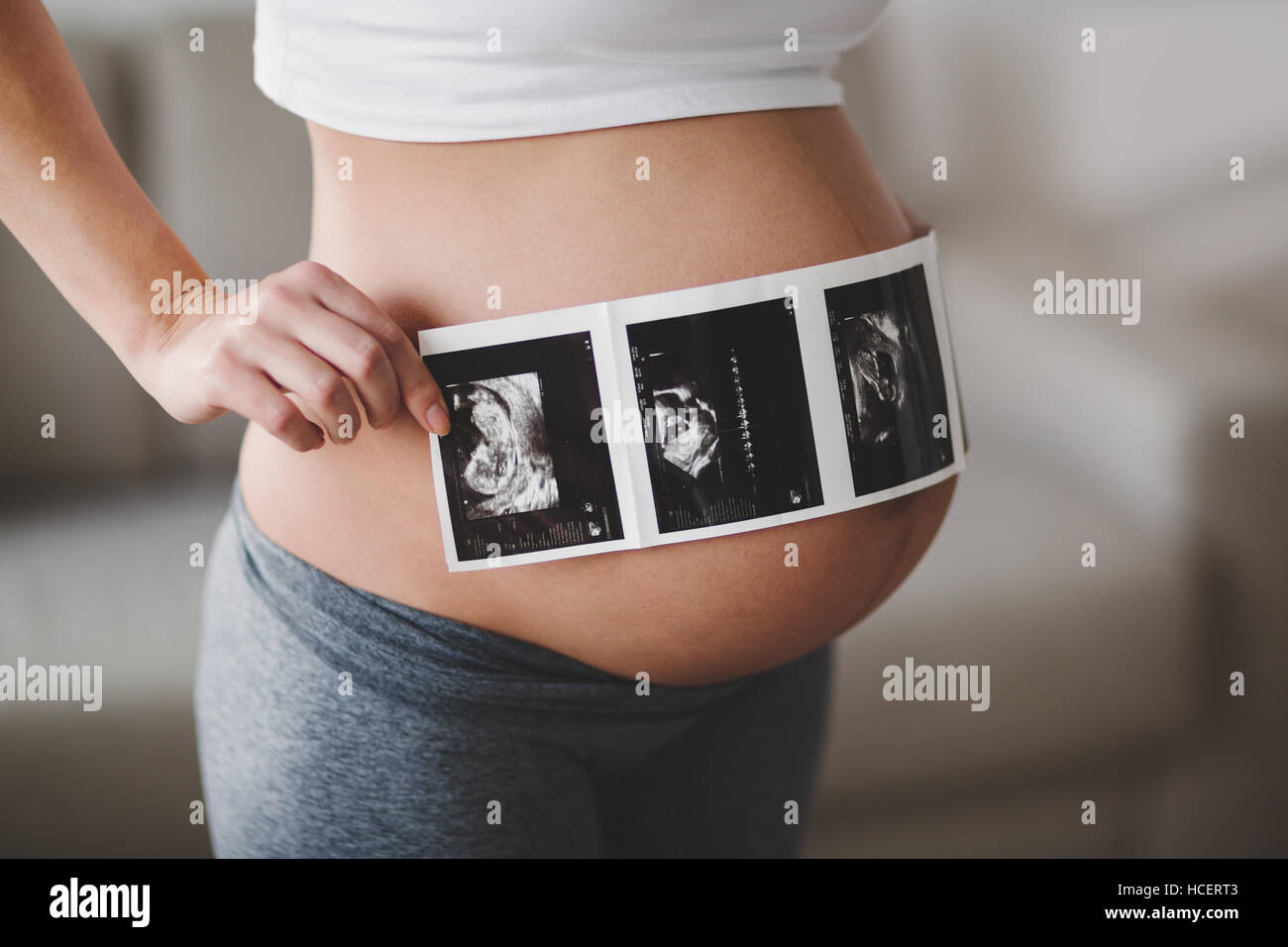 Schwangere Frau erwarten Neugeborenen und hält Ultraschall Stockfoto