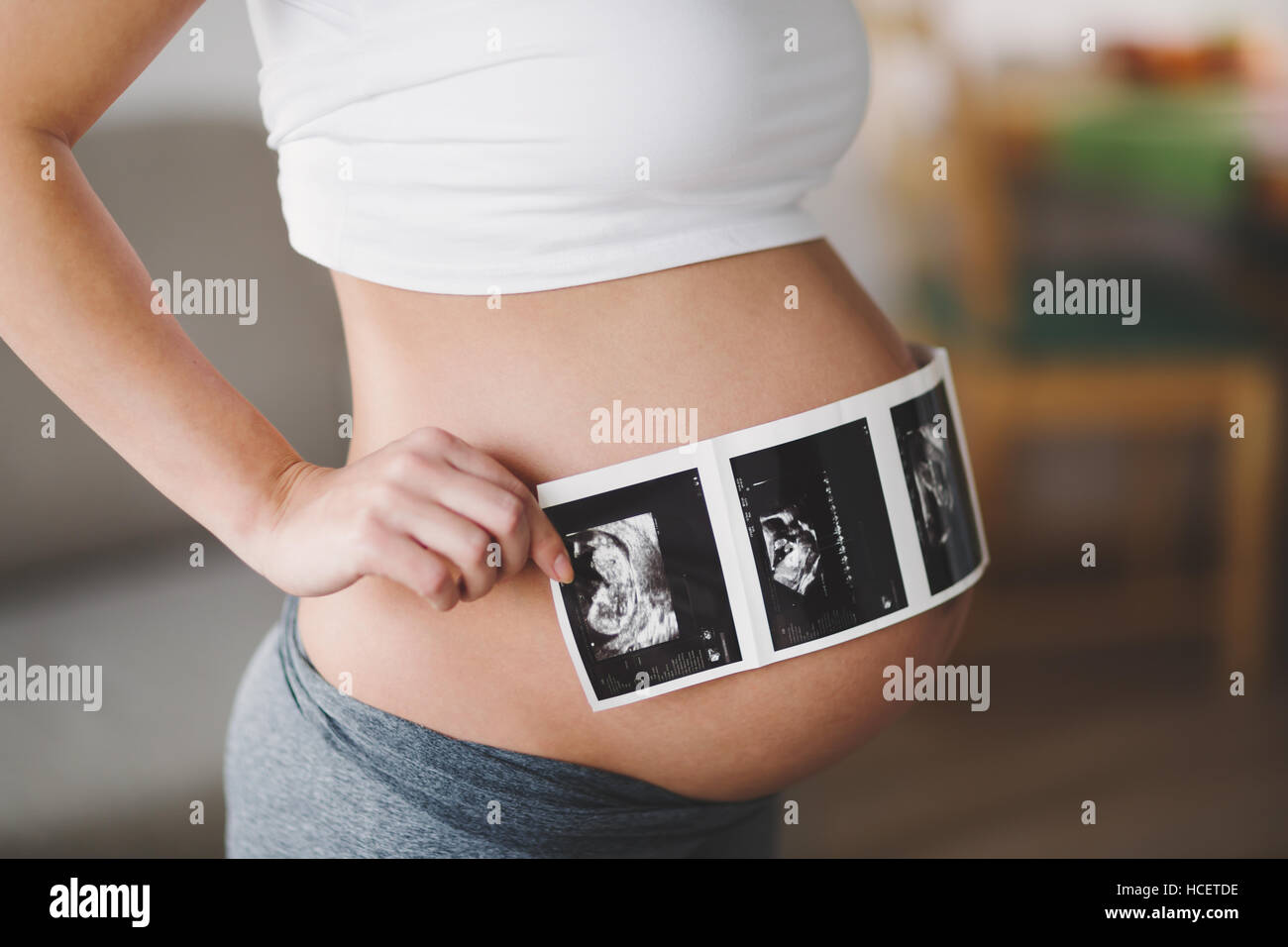 Schwangere Frau erwarten Neugeborenen und hält Ultraschall Stockfoto