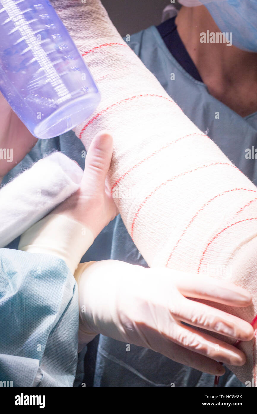 Bandagierung nach chirurgischer Eingriff Knie Arthroskopie Mikrochirurgie  in Krankenhaus OP Notaufnahme für Krankenschwester Stockfotografie - Alamy