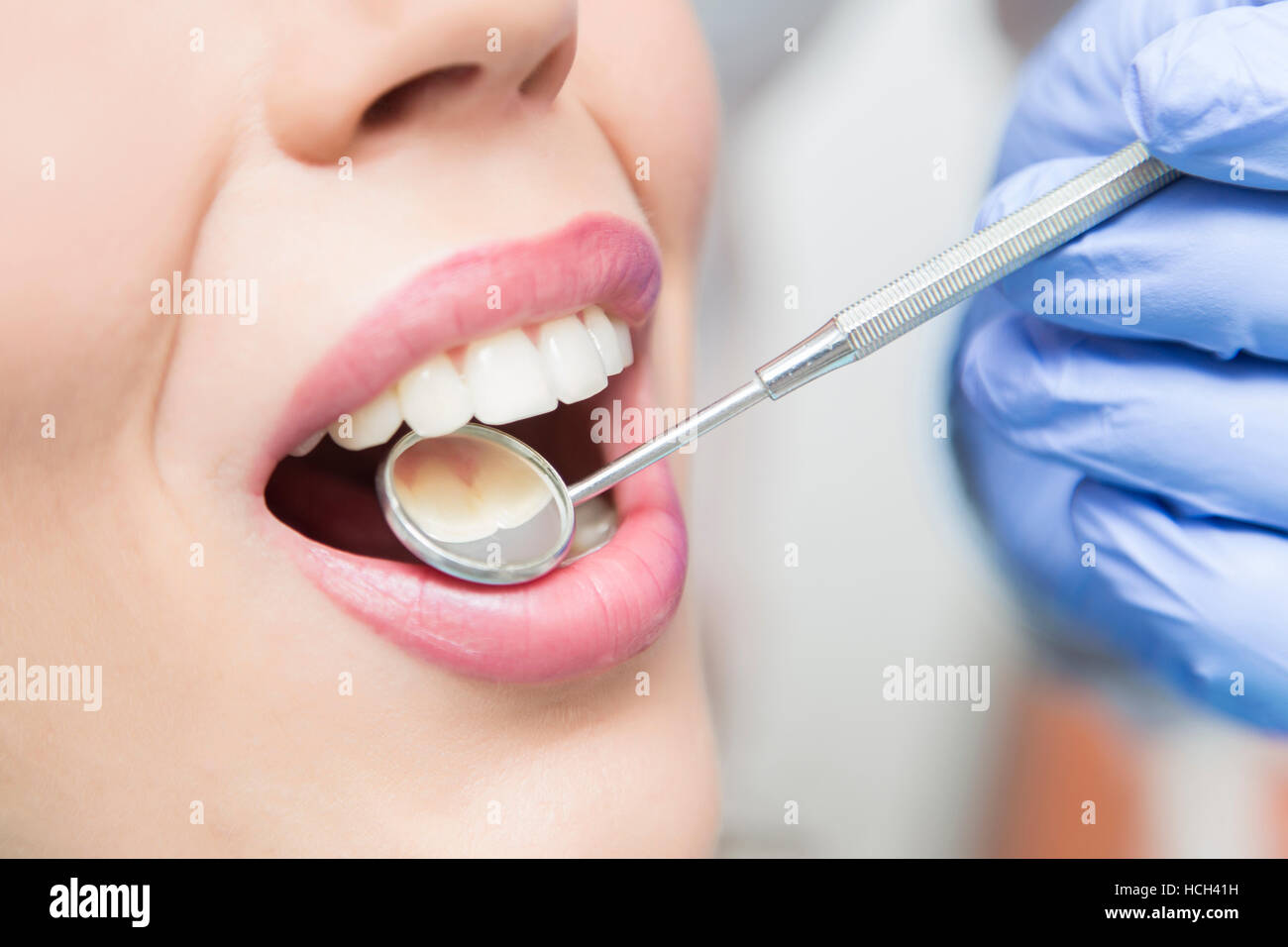 Nahaufnahme des geöffneten Mund während oralen Untersuchung beim Zahnarzt Stockfoto