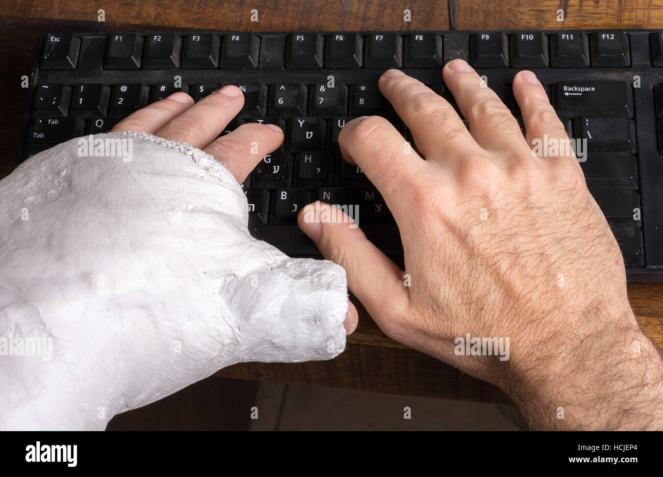 Junge Mann trägt einen Gipsarm nach dem Bruch seines Handgelenks Schwierigkeiten auf einer Computertastatur tippen Stockfoto