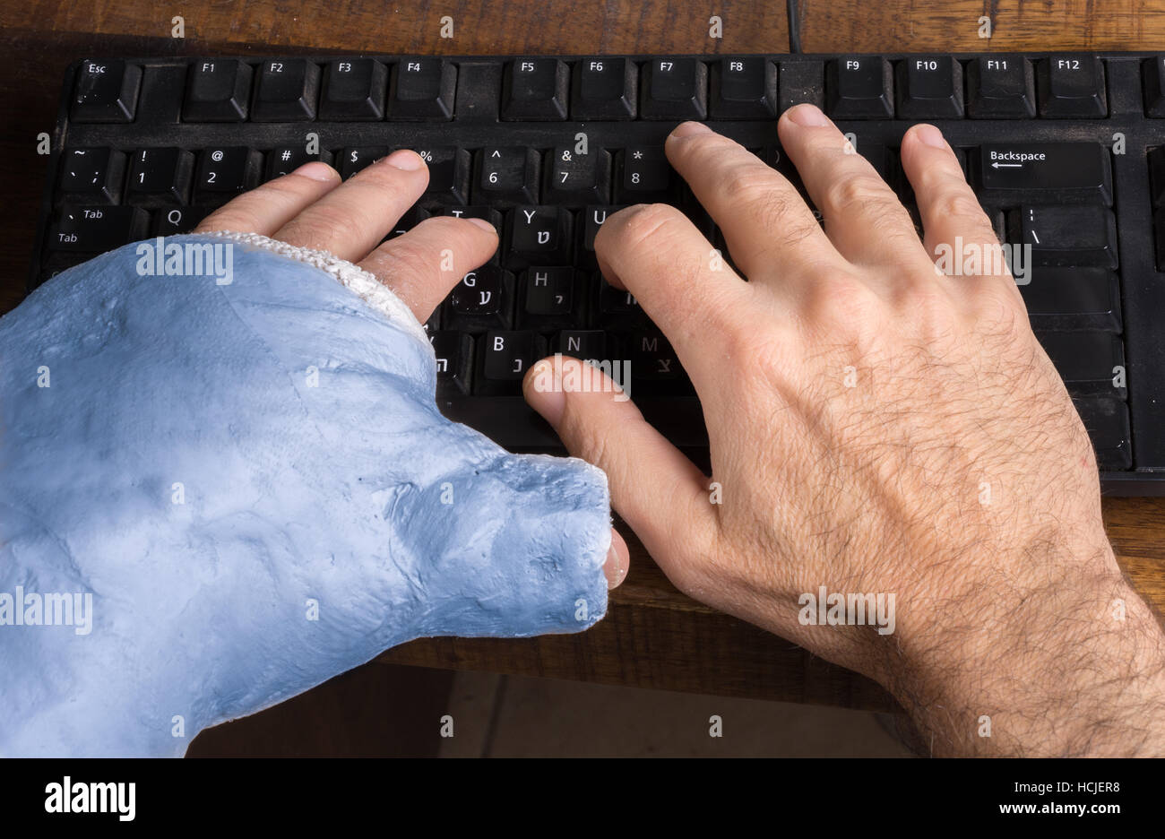 Junge Mann trägt einen blauen Gipsarm nach dem Bruch seines Handgelenks Schwierigkeiten auf einer Computertastatur tippen Stockfoto