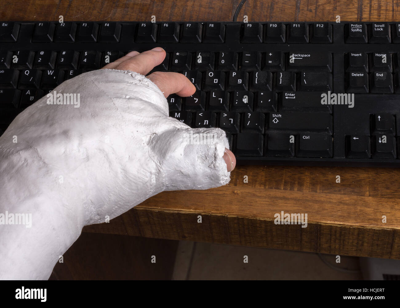 Person trägt einen Gipsarm nach der Trennung von ihrem Handgelenk Schwierigkeiten auf einer Computertastatur tippen Stockfoto