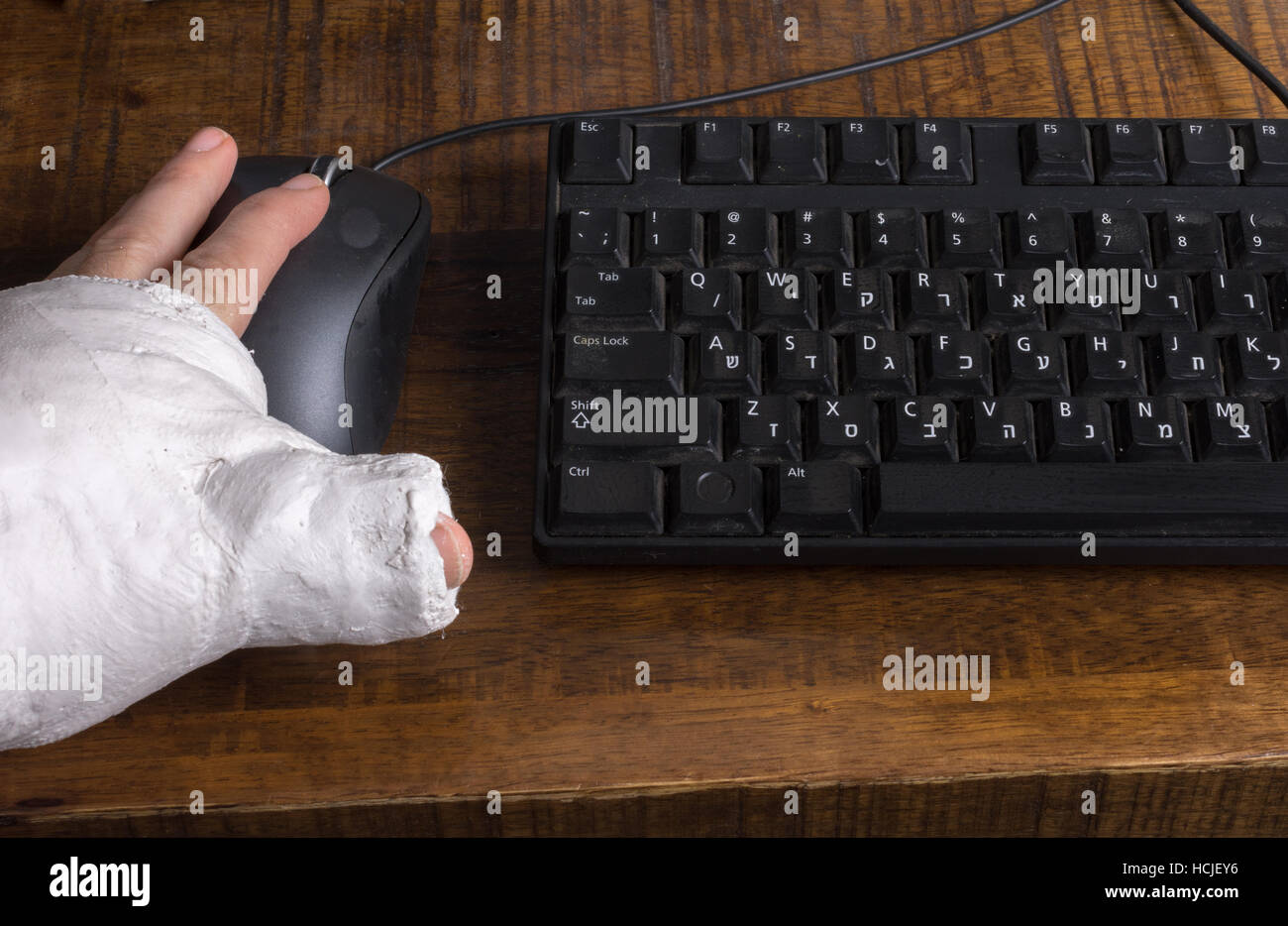 Eine Person trägt einen Gipsarm nach der Trennung von ihrem Handgelenk Schwierigkeiten mit einer Computermaus Stockfoto