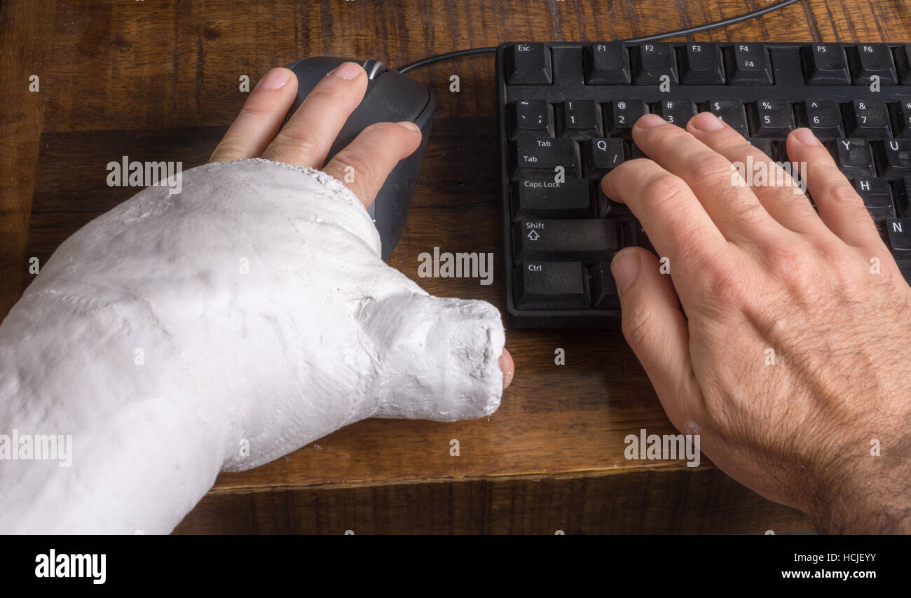 Junge Mann trägt einen Gipsarm nach der Trennung von seinem Handgelenk Schwierigkeiten mit einer Computermaus Stockfoto