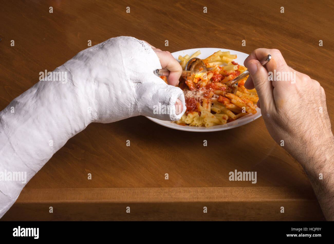 Junge Mann trägt einen Gipsarm nach dem Bruch seines Handgelenks Schwierigkeiten haben, eine Mahlzeit Nudeln in Tomatensauce Stockfoto
