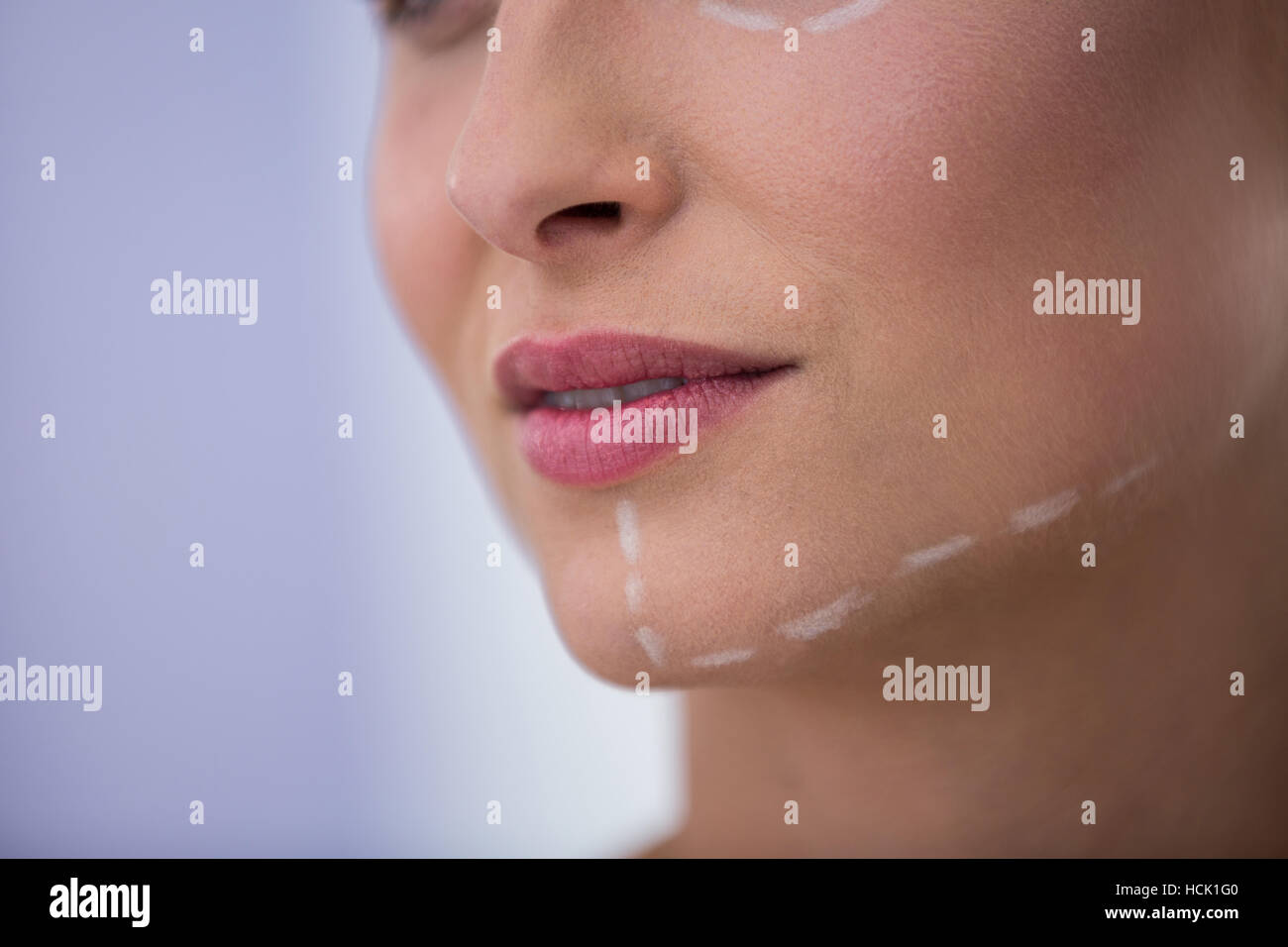 Frau mit Markierungen für die kosmetische Behandlung auf ihr Kinn gezogen Stockfoto