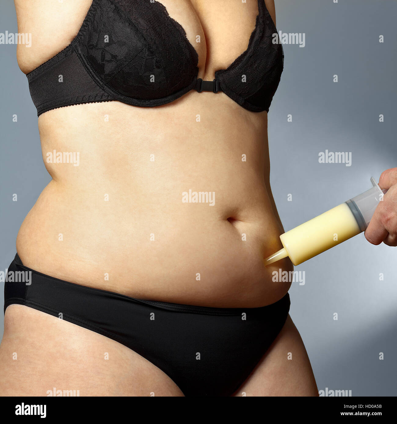 Körper eine rundliche Frau in BH und Hosen mit einem männlichen Hand eine Spritze mit Fett aus dem Bauch gesaugt Fettabsaugung Stockfoto
