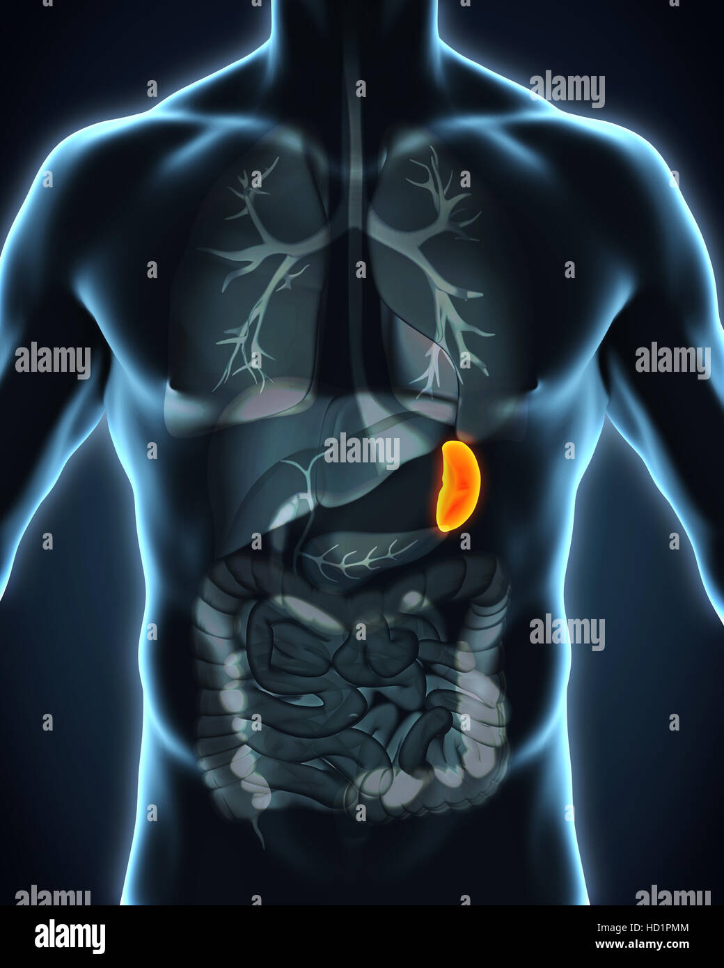 Understanding Milzschmerzen Causes And Symptoms XMTX Understanding Milzschmerzen Causes And Symptoms XMTX