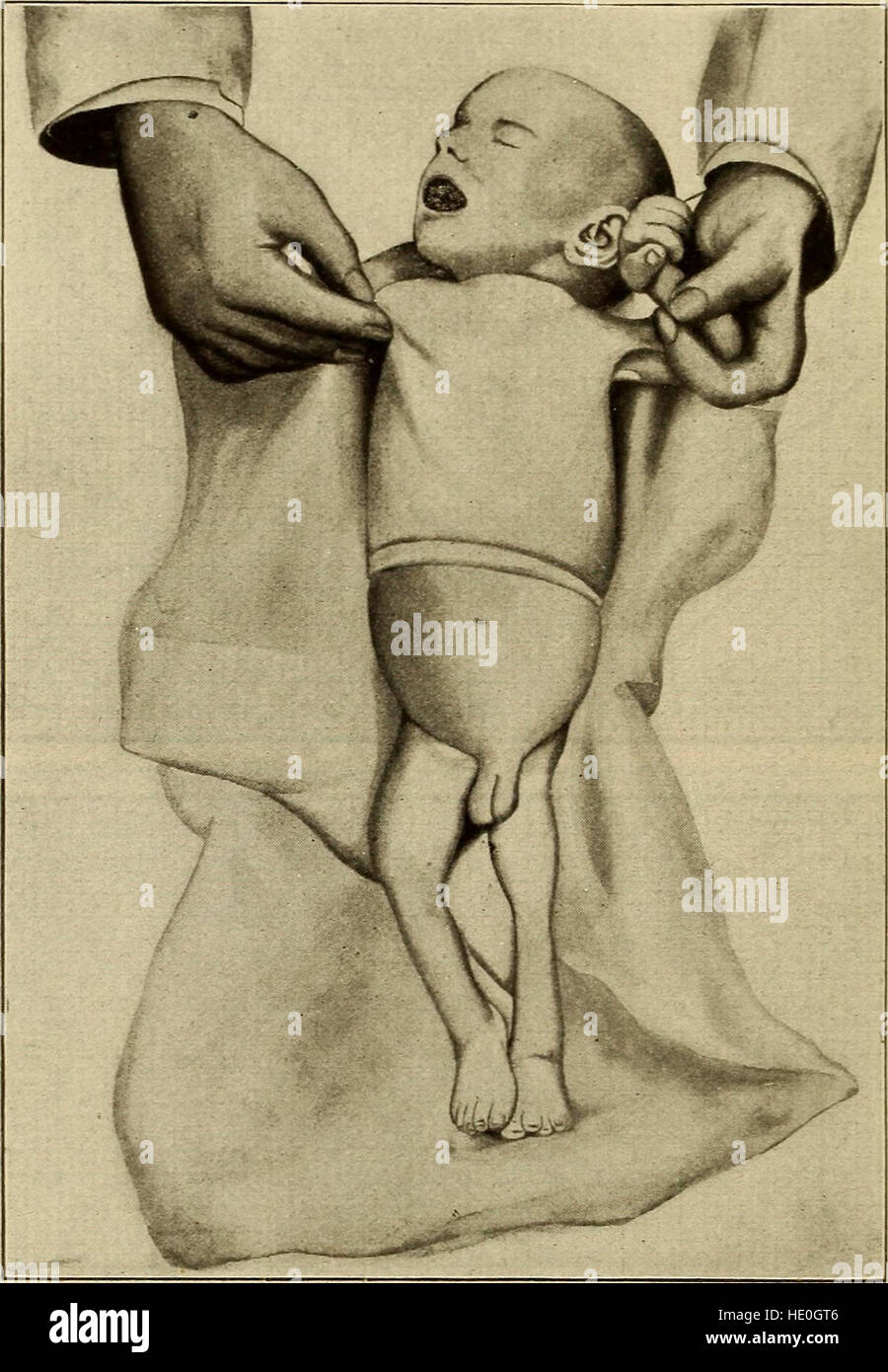 „Krankheiten des Säuglings und der Kindheit“ (1914) ist ein medizinischer Text, der umfassende Informationen über die häufigen und seltenen Krankheiten von Säuglingen und Kindern enthält und die Symptome, Behandlungen und Präventionsmethoden detailliert beschreibt. Stockfoto