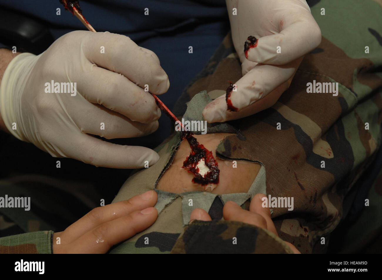 SPANGDAHLEM AIR BASE, Deutschland--techn. Sgt Stephen Deris, 52. Dental Squadron, gilt eine offene Wunde Moulage für Flieger 1. Klasse Charline Castro, 52. Mission Support Squadron, während Übung Saber Krone 08 / 06, 22. April 2008. Staff Sgt. Kristin Ruleau) (veröffentlicht) Stockfoto