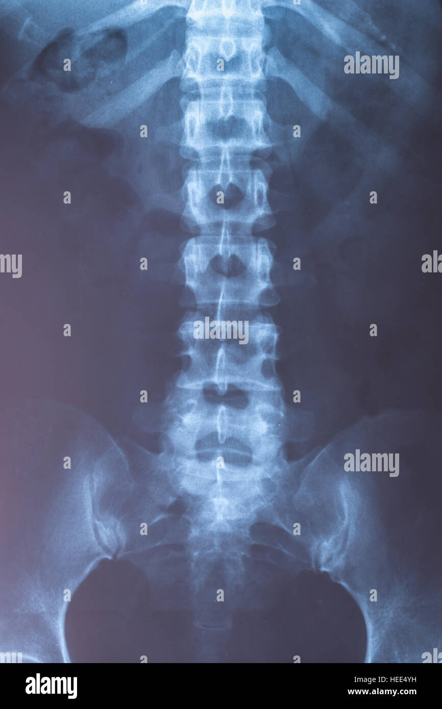 Röntgenbild des menschlichen für eine medizinische Diagnose hautnah Stockfoto