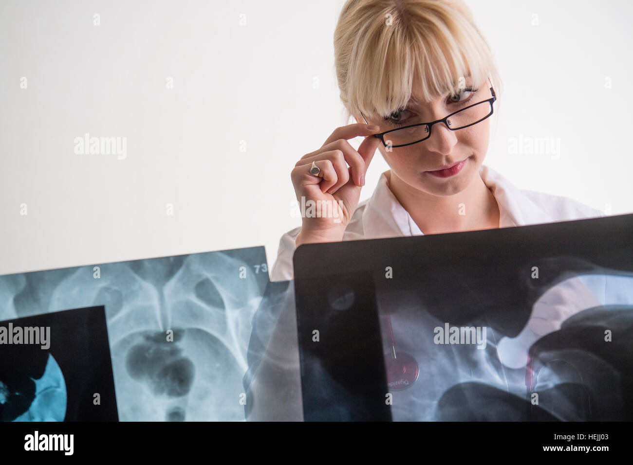 UK Health Care Professionals: A National Health Service (NHS) weibliche Ärztin Blick auf eine Reihe von Röntgenaufnahmen des Patienten Stockfoto