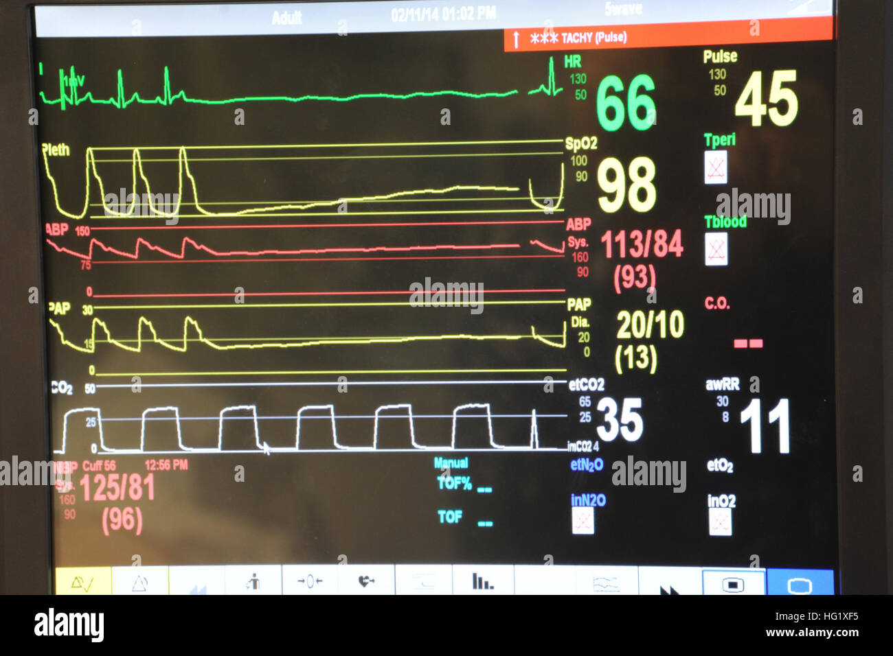 Ein Vitalparameter-Monitor zeigt die Herzfrequenz, Sauerstoffsättigung und Blutdruck bei einem simulierten Patienten am Naval Hospital Pensacola. Vitalzeichen überwachen display Stockfoto