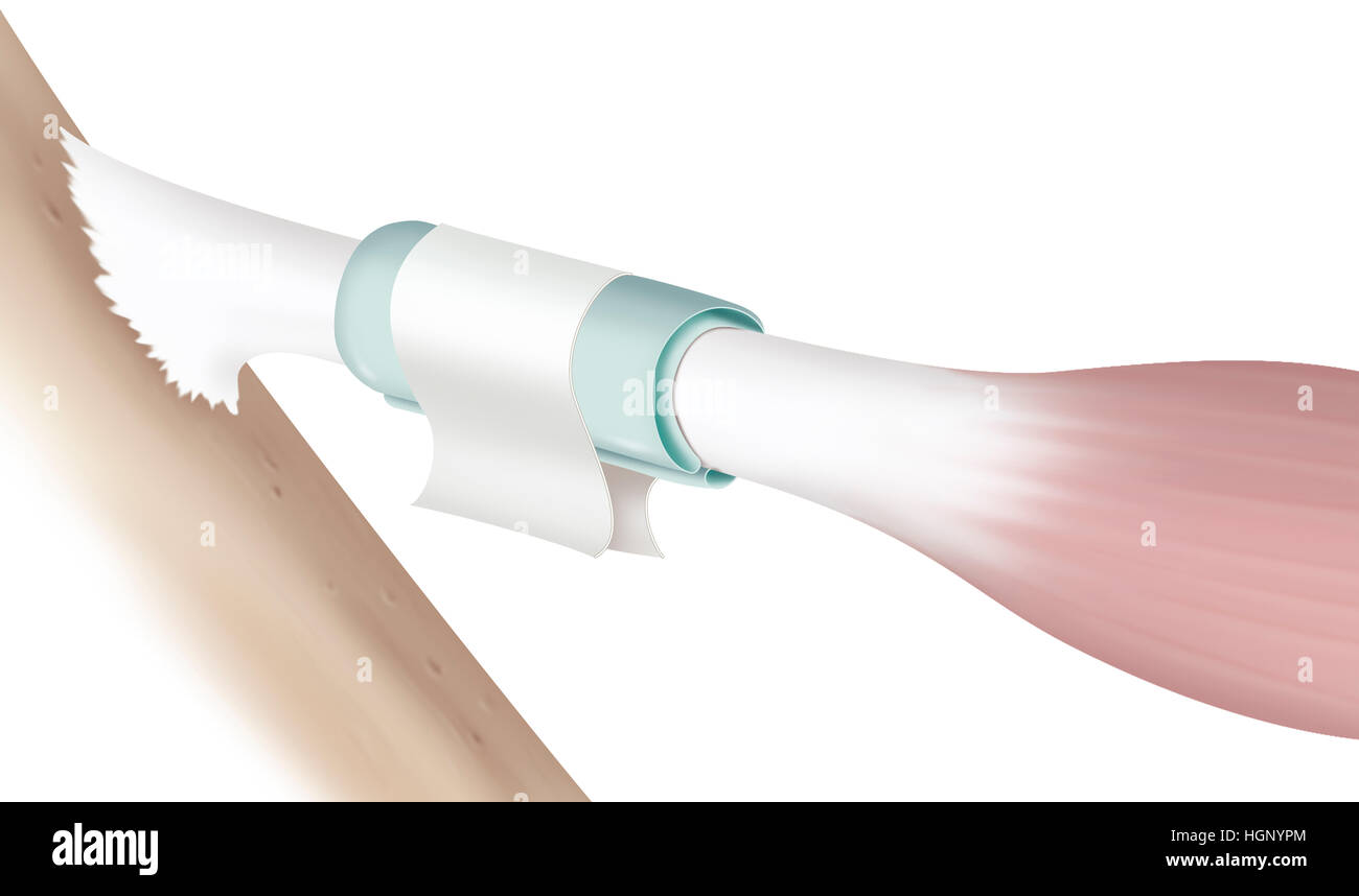 SEHNE, ILLUSTRATION Stockfoto