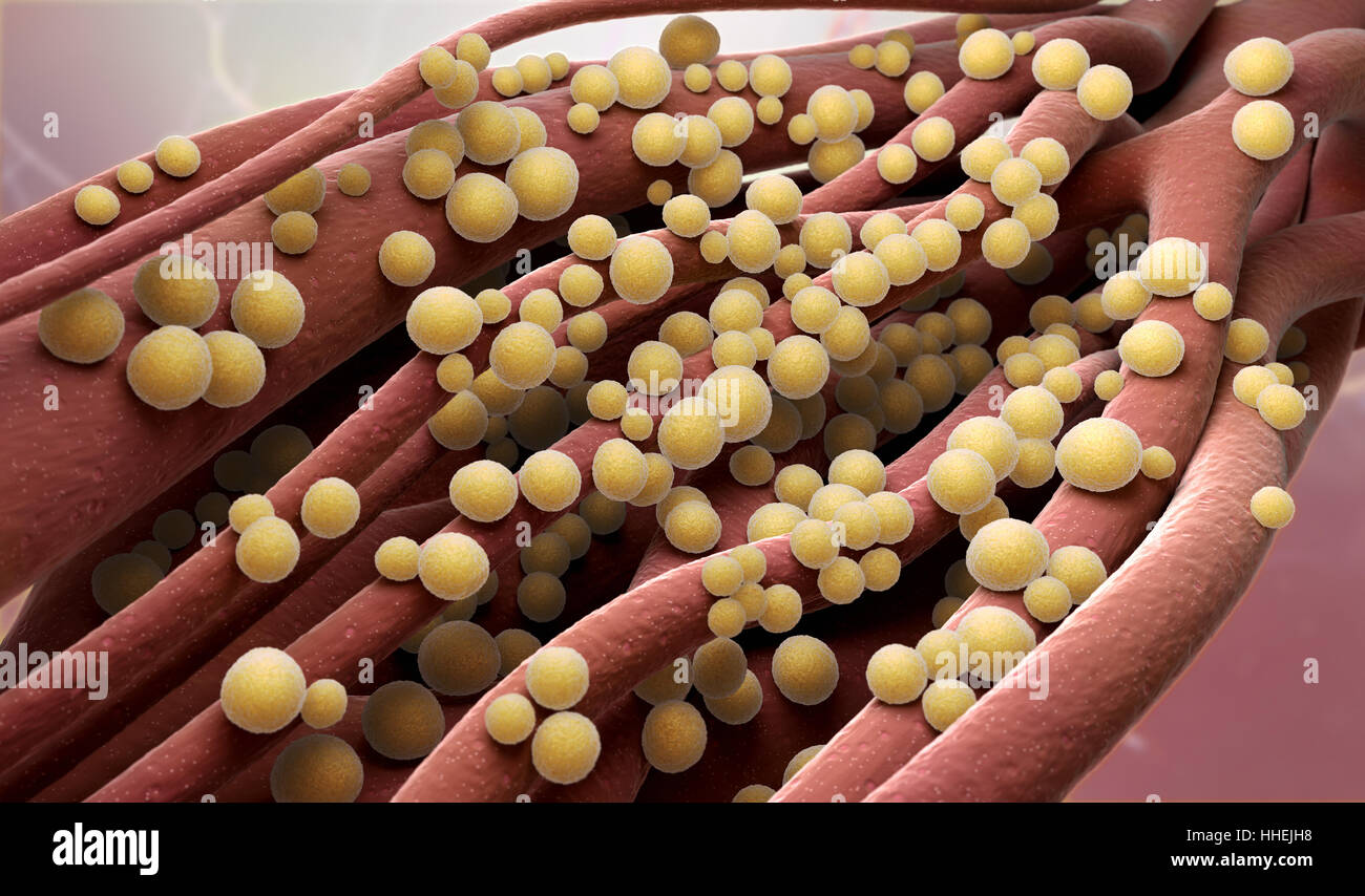 Staphylococcus aureus Stockfoto