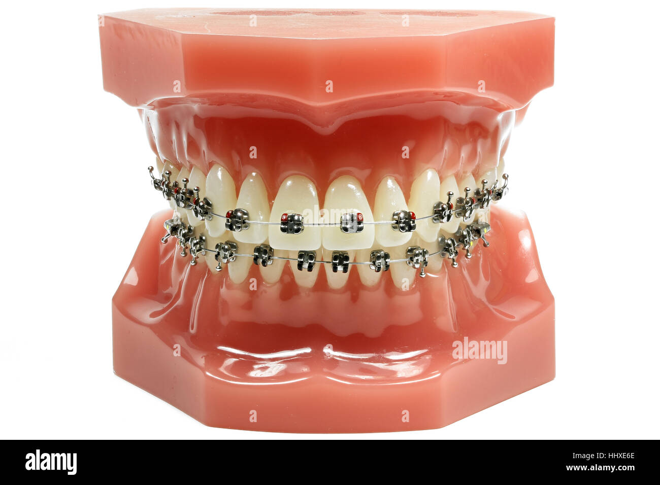 Zahnspangenmodell -Fotos und -Bildmaterial in hoher Auflösung – Alamy