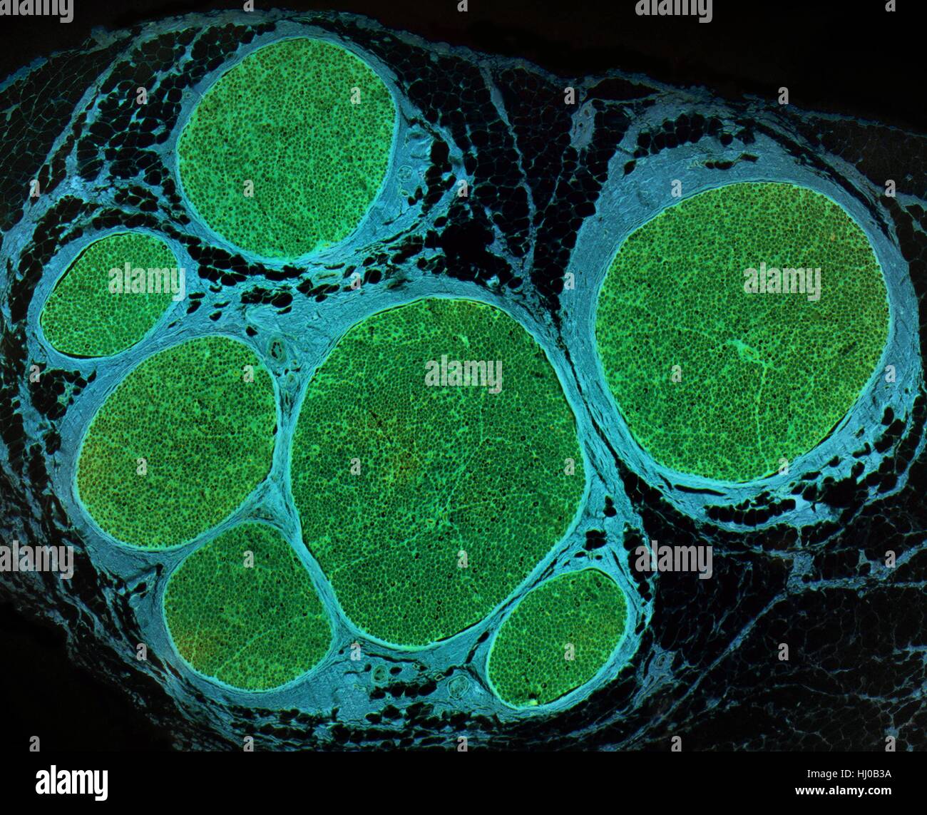 Nervenfasern. Leichte Schliffbild (LM) des einen Querschnitt durch ein Bündel (Faszikel) von Nervenfasern. Innerhalb jedes Faszikel sind viele Markhaltige Nervenfasern. Myelin (grün) ist eine isolierende Fettschicht, die einzelnen Nervenfasern genannt Axone, die Erhöhung der Geschwindigkeit bei der Nervenimpulse Reisen umgibt. Die Fasern innerhalb jedes Faszikel zu unterstützen, ist das Endoneurium, die eine Form des Bindegewebes. Das Perineurium umgibt jeden Faszikel, die sind wiederum durch epineurial Bindegewebe (Cyan) gebunden. Vergrößerung: X80 beim Drucken 10 cm breit. Stockfoto