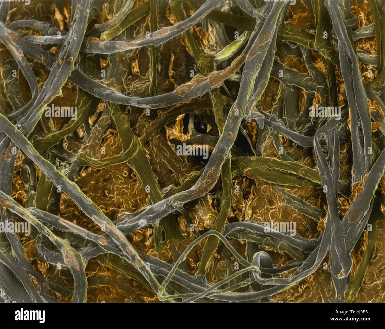Wattestäbchen mit Ohrenschmalz in Fasern eingebettet, farbige scanning Electron Schliffbild (SEM). Ein Wattestäbchen ist ein kleiner Stick mit einem Wattestäbchen an einem oder beiden Enden. Es dient als ein Reinigungswerkzeug für Ohren, aber hat viel anderen Gebrauch einschließlich Schönheit, Kosmetik, Haushalt, Reinigung, pet Care, Baby-Pflege, Reinigung von Oberflächen aller Arten von Oberflächen und erste Hilfe. Vergrößerung: X34 wenn kürzeste Achse bei 25 Millimetern gedruckt. Stockfoto