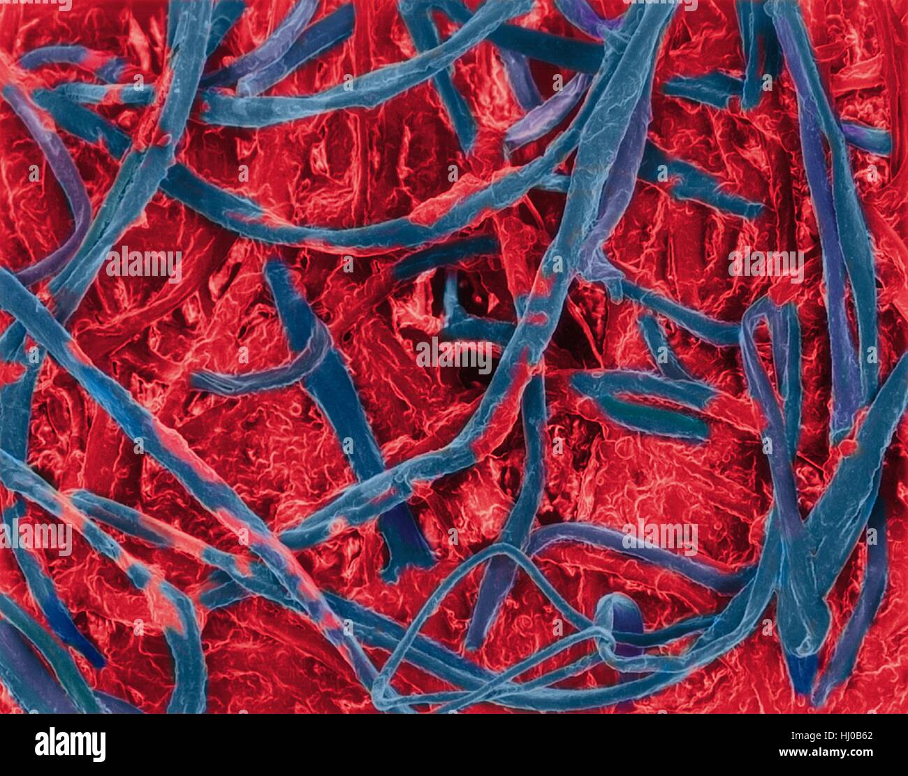 Wattestäbchen mit Ohrenschmalz in Fasern eingebettet, farbige scanning Electron Schliffbild (SEM). Ein Wattestäbchen ist ein kleiner Stick mit einem Wattestäbchen an einem oder beiden Enden. Es dient als ein Reinigungswerkzeug für Ohren, aber hat viel anderen Gebrauch einschließlich Schönheit, Kosmetik, Haushalt, Reinigung, pet Care, Baby-Pflege, Reinigung von Oberflächen aller Arten von Oberflächen und erste Hilfe. Vergrößerung: X34 wenn kürzeste Achse bei 25 Millimetern gedruckt. Stockfoto