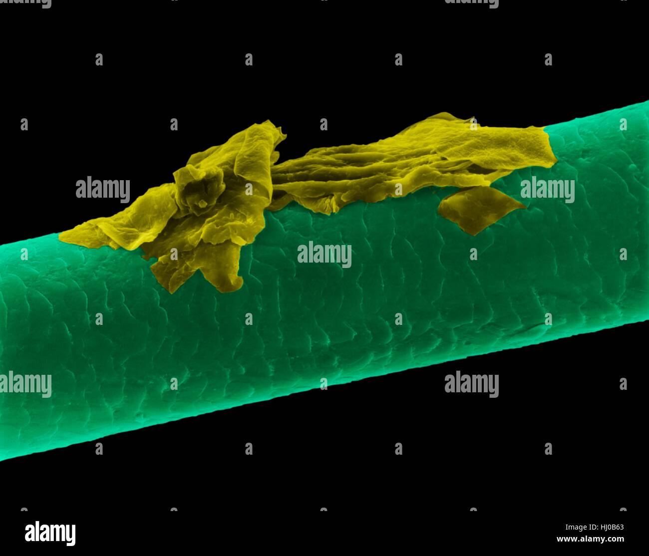 Menschliches Haar Schuppen, farbige scanning Electron Schliffbild (SEM). Die äußere Schicht des Haares (Cuticula) hat überlappende Schuppen aus Keratin. Diese Skalen werden gedacht, um zu verhindern, dass Haare Matten zusammen. Haar besteht aus faserigen Protein Keratin genannt. Intern gliedert sich Haarschaft in drei konzentrischen Hüllen (Schichten) genannt Medulla, Kortex äußeren Cuticula. Das Haar ist nicht lebendes Gewebe. Haare wachsen aus der Haarwurzel (Birne) in Haut eingebettet. Haarwuchs tritt auf, wenn die epidermale Zellen auf Basis der Haarwurzel teilen. Das Haar ist nicht lebendes Gewebe. Vergrößerung: X115 wenn kürzeste Achse bei 25 Millimetern gedruckt. Stockfoto