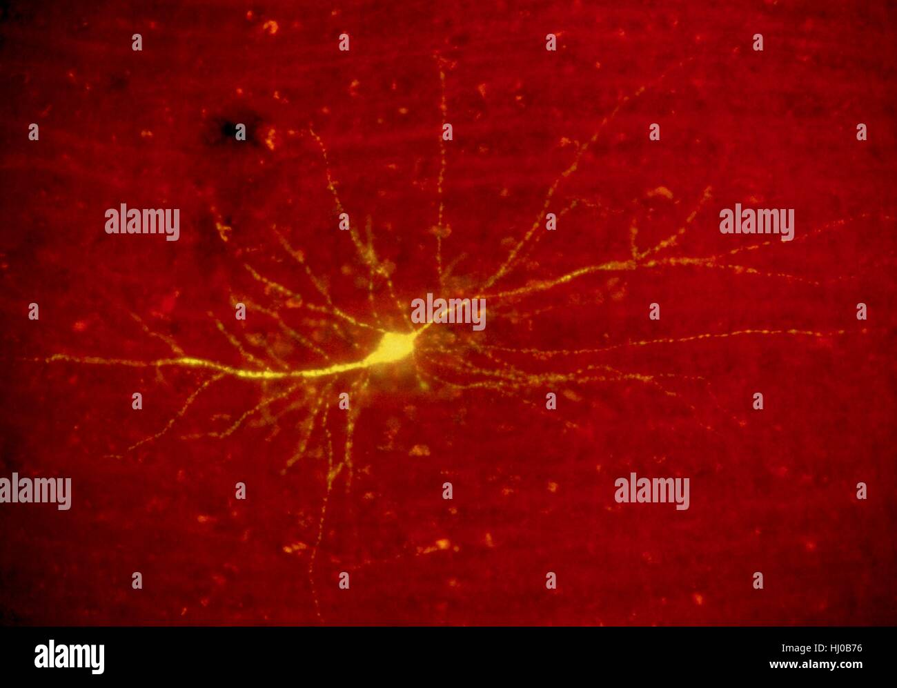 Fluoreszenz Licht Schliffbild des menschlichen Gehirns stellate Neuron. Dieses Ganglion Neuron hat Flecken Fluoreszenzfarbstoff Luzifer Yellow.The Hirnrinde ist Schicht von Nervengewebe, das äußerste zu Großhirn Kleinhirn des Gehirn von Säugetieren. Es ist namens grauen Substanz des Gehirns aufgrund von Nervenfasern, die Stockfoto