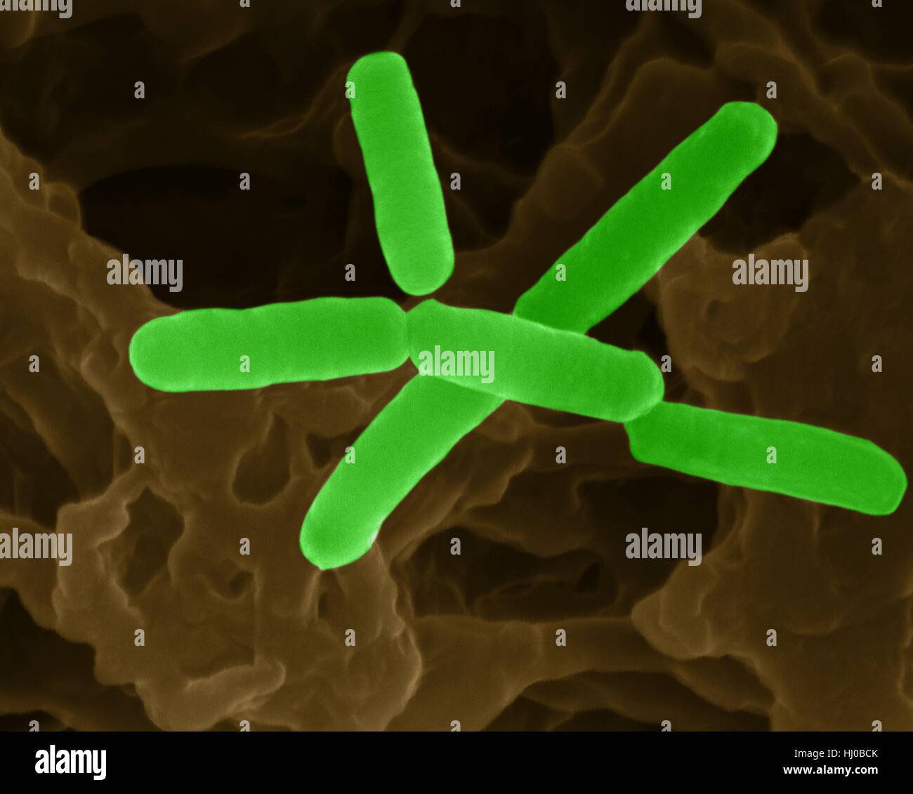 Farbige scanning Electron Schliffbild (SEM) von Bradyrhizobium ist Gattung Gram-Negative, Bodenbakterien in Familie Bradyrhizobiaceae.Many Arten dieser Gattung Verlegenheit Stickstoff. Es bildet symbiotische Beziehung moduliert Pflanze Wurzelsysteme (Hülsenfrüchte). Die Bakterien enthalten Nitrogenase Enzym-System, Stockfoto