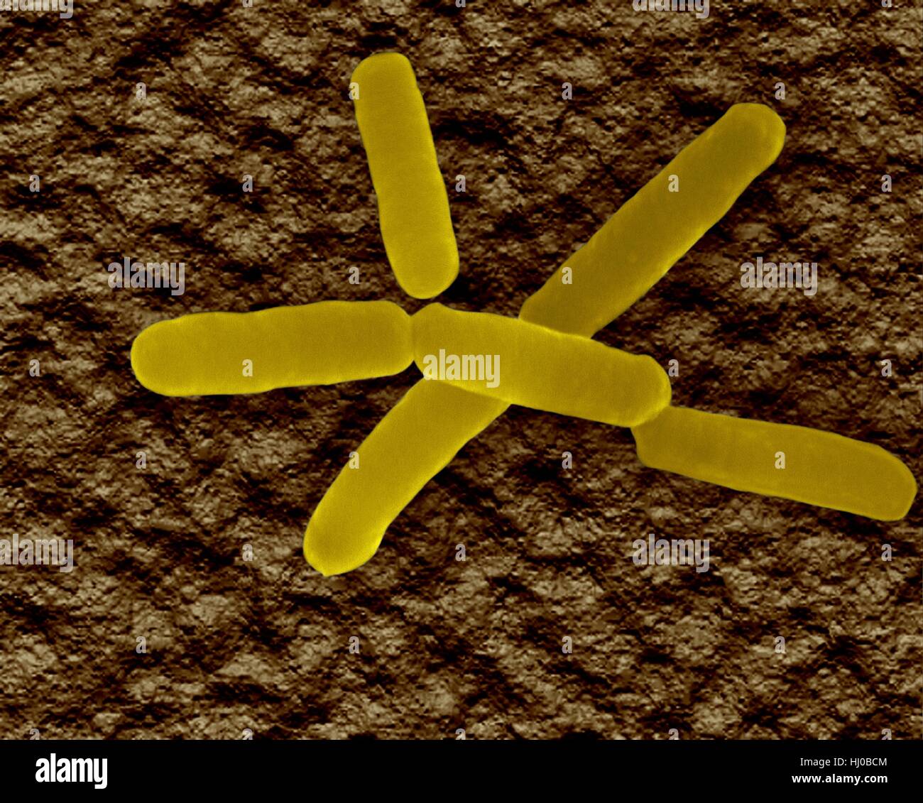 Farbige scanning Electron Schliffbild (SEM) von Bradyrhizobium ist Gattung Gram-Negative, Bodenbakterien in Familie Bradyrhizobiaceae.Many Arten dieser Gattung Verlegenheit Stickstoff. Es bildet symbiotische Beziehung moduliert Pflanze Wurzelsysteme (Hülsenfrüchte). Die Bakterien enthalten Nitrogenase Enzym-System, Stockfoto