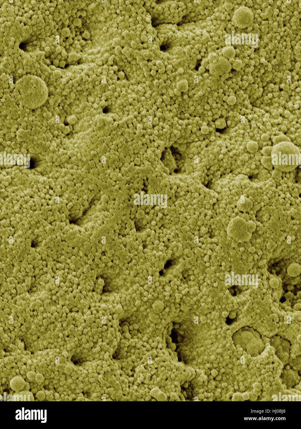 Farbige Elektron Schliffbild (SEM) Huhn Eierschale Scanfläche (Gallus Gallus Domesticus). Hier sind Oberfläche Mineralkristalle, die viele winzige Poren in der Eierschale Vogel bilden. Eierschalen sind äußere Abdeckung der hartschaligen Eiern von anderen Eiern weichen äußeren Schichten. Eierschale Struktur variiert stark zwischen Stockfoto
