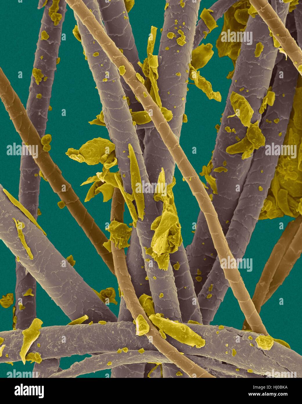 Farbige scanning Electron Schliffbild (SEM) Pet dander.dog Haar, abgestorbene Hautschüppchen Katzenhaare (Katze-hair.brown,dog-hair.purple,dander.yellow). Hund-Katzen produzieren menschlichen Allergene. Haustier Dander ist Material vom Körper von verschiedenen Tieren (häufig Katzen Hunde) vergossen. Es kann Schuppen getrocknete Haut Haare enthalten. Stoffen im Stockfoto