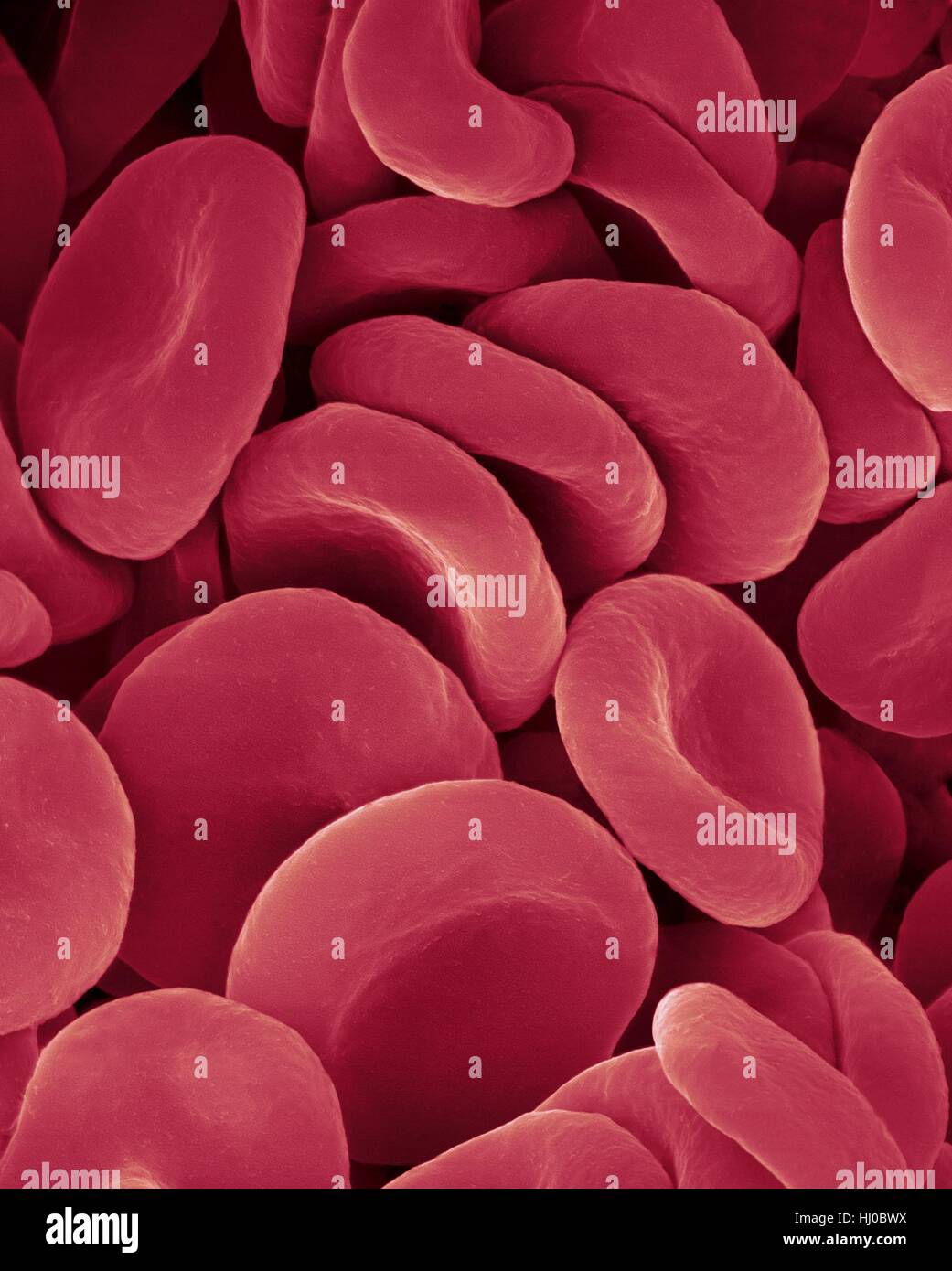 Menschlichen Erythrozyten, farbige scanning Electron Schliffbild (SEM). Rote Blutkörperchen (Erythrozyten) oder Erythrozyten, sind die allgemeinste Art der Blutkörperchen bei Wirbeltieren. Sie engagieren sich im Körpergewebe Sauerstoff bereitzustellen. Erythrozyten nehmen Sauerstoff in den Lungen oder Kiemen lassen Sie ihn in das Gewebe beim Quetschen durch Stockfoto