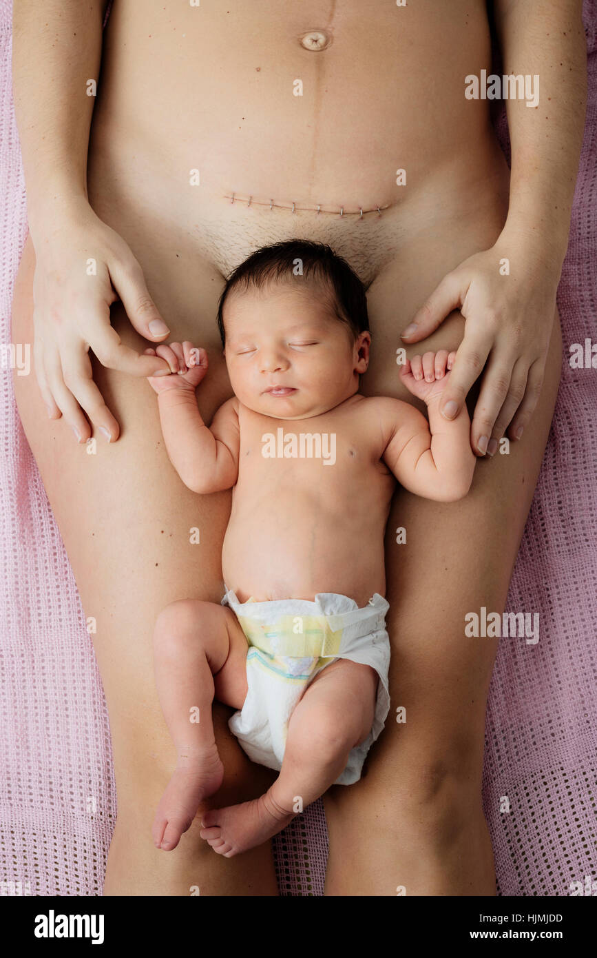 Neugeborenes Babymädchen liegt auf Mutters Schenkel in der Nähe einer jüngsten Kaiserschnitt Narbe mit Heftklammern Stockfoto