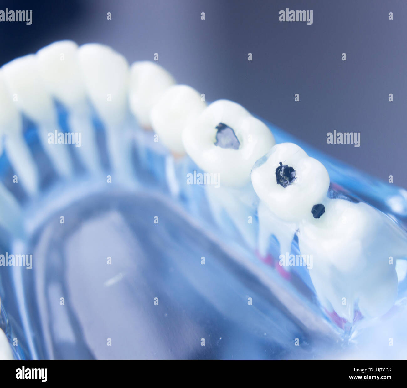 Dental Zahn Zahnmedizin Lernerfolge Lehrmodell zeigt Zähne, Wurzeln