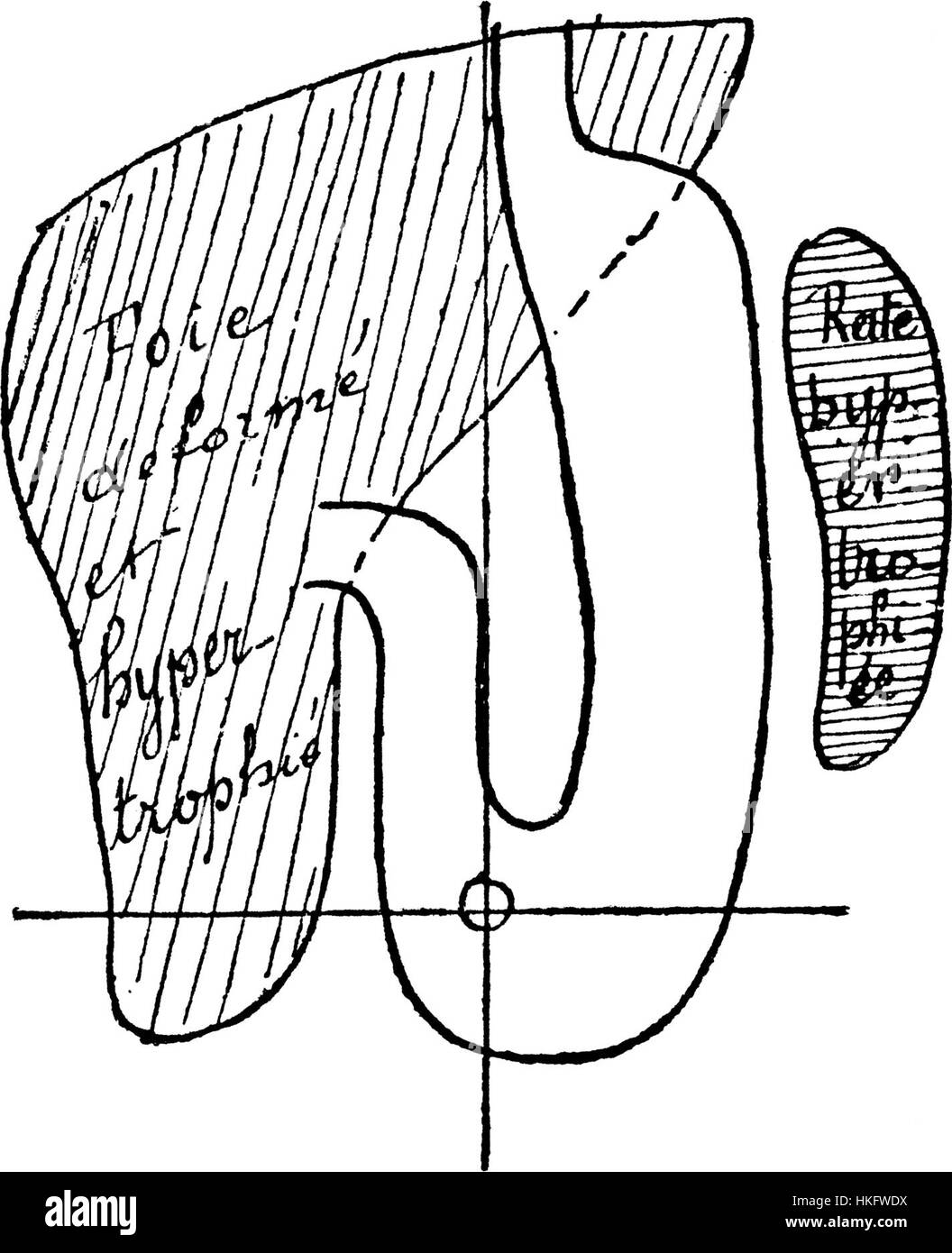 Dieses Bild aus einem antiken medizinischen Illustrationsbuch mit dem Titel „EstomacCorset page058“ zeigt eine detaillierte anatomische Zeichnung eines Korsetts. Die Arbeit verbindet medizinische Illustration mit früherem Modedesign und bietet einen Einblick in die Schnittstelle von Mode und Gesundheit. Stockfoto