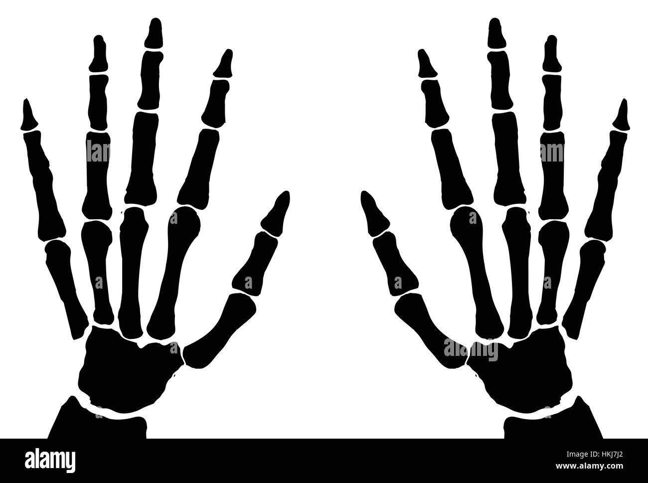 Die Knochen der Hand Röntgen isoliert auf weißem Hintergrund Stock Vektor