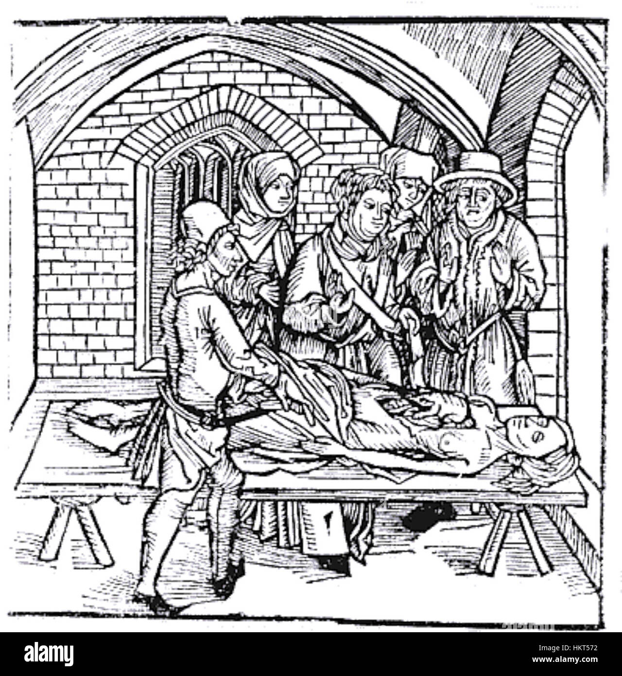 Ein Kunstwerk, inspiriert von den detaillierten anatomischen Studien Albrecht Dürers, das möglicherweise eine Autopsie-Szene darstellt und den Fokus des Künstlers auf menschliche Anatomie und wissenschaftliche Beobachtung zeigt. Stockfoto